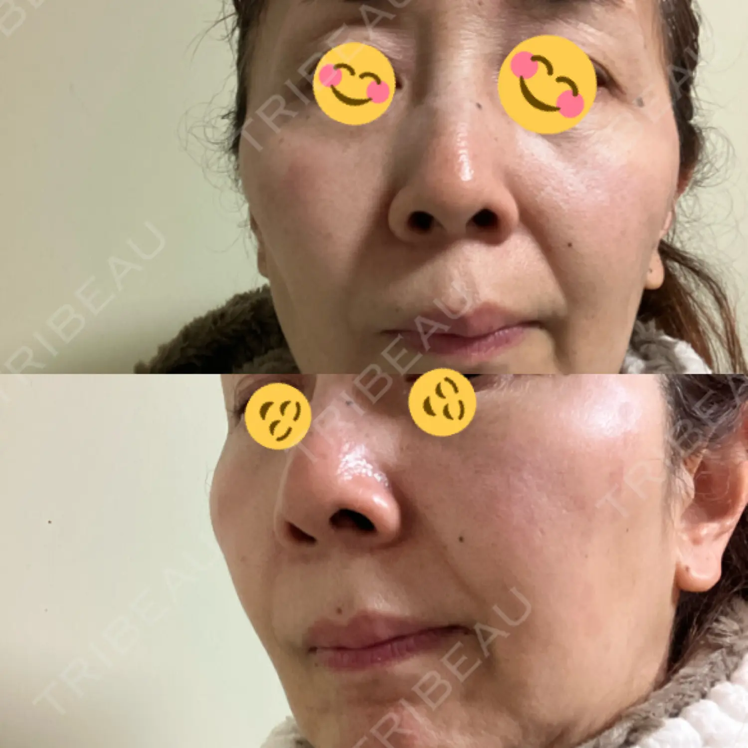 施術後の写真