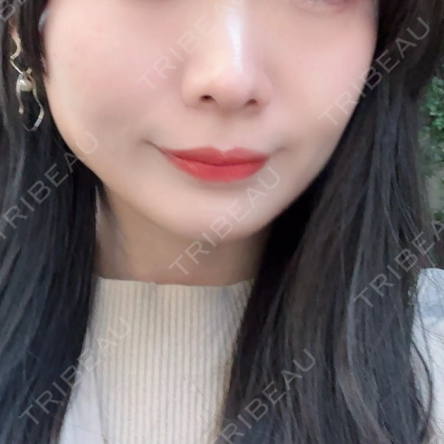 施術後の写真