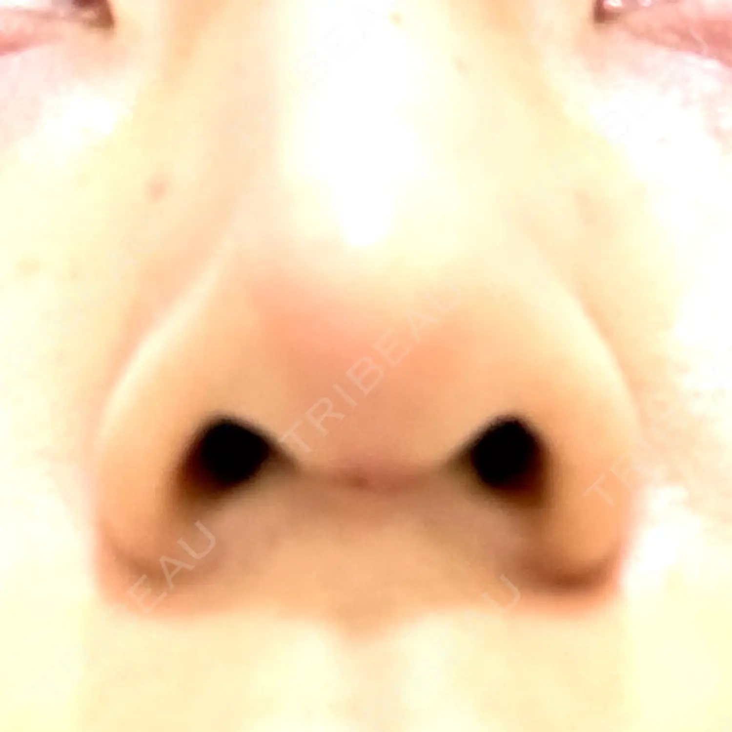 施術後の写真