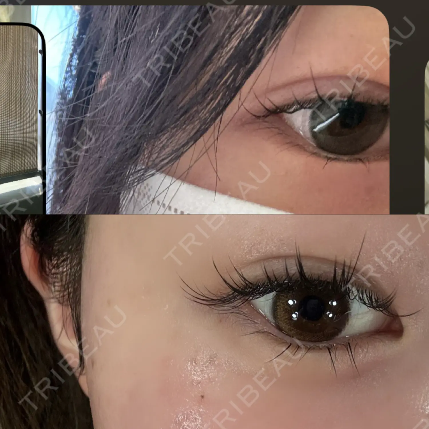 施術後の写真