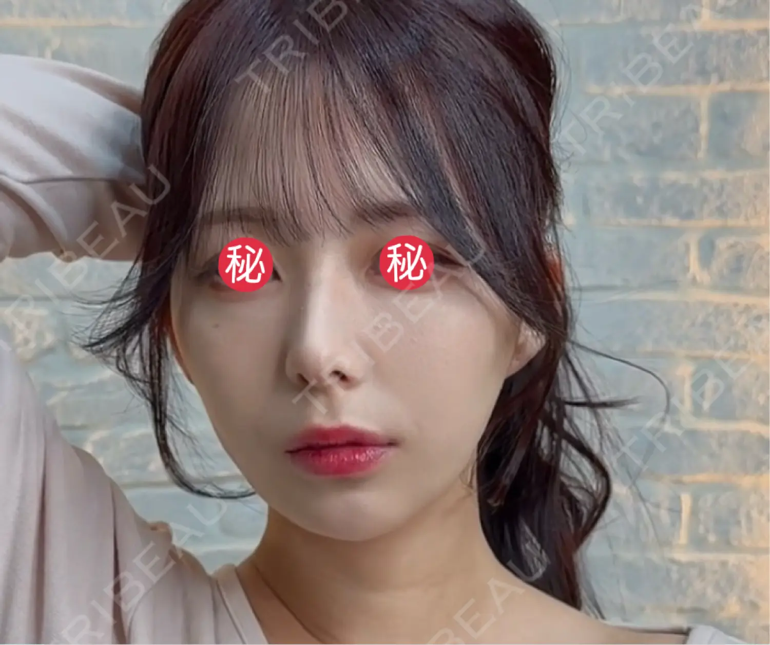 施術後の写真