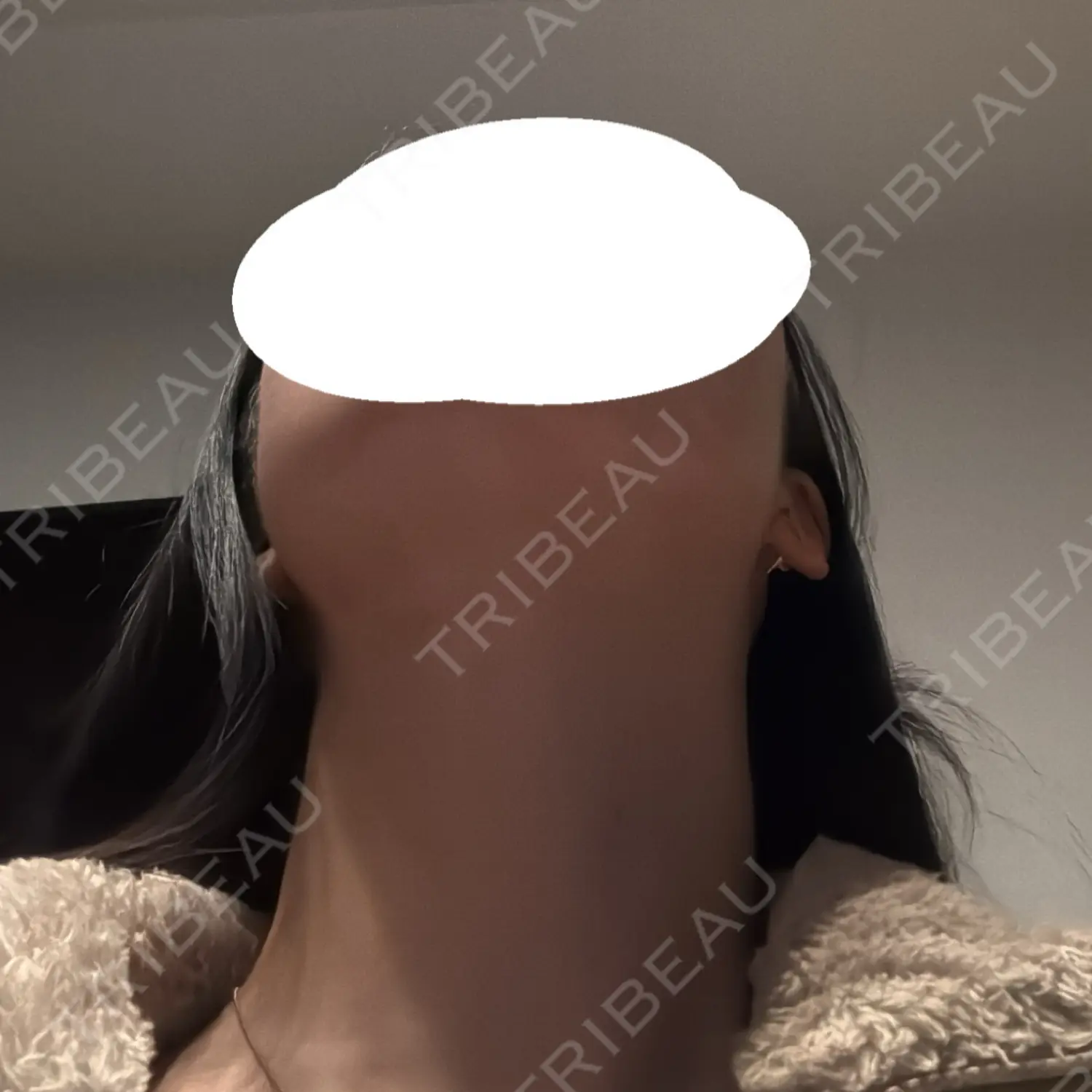 施術後の写真