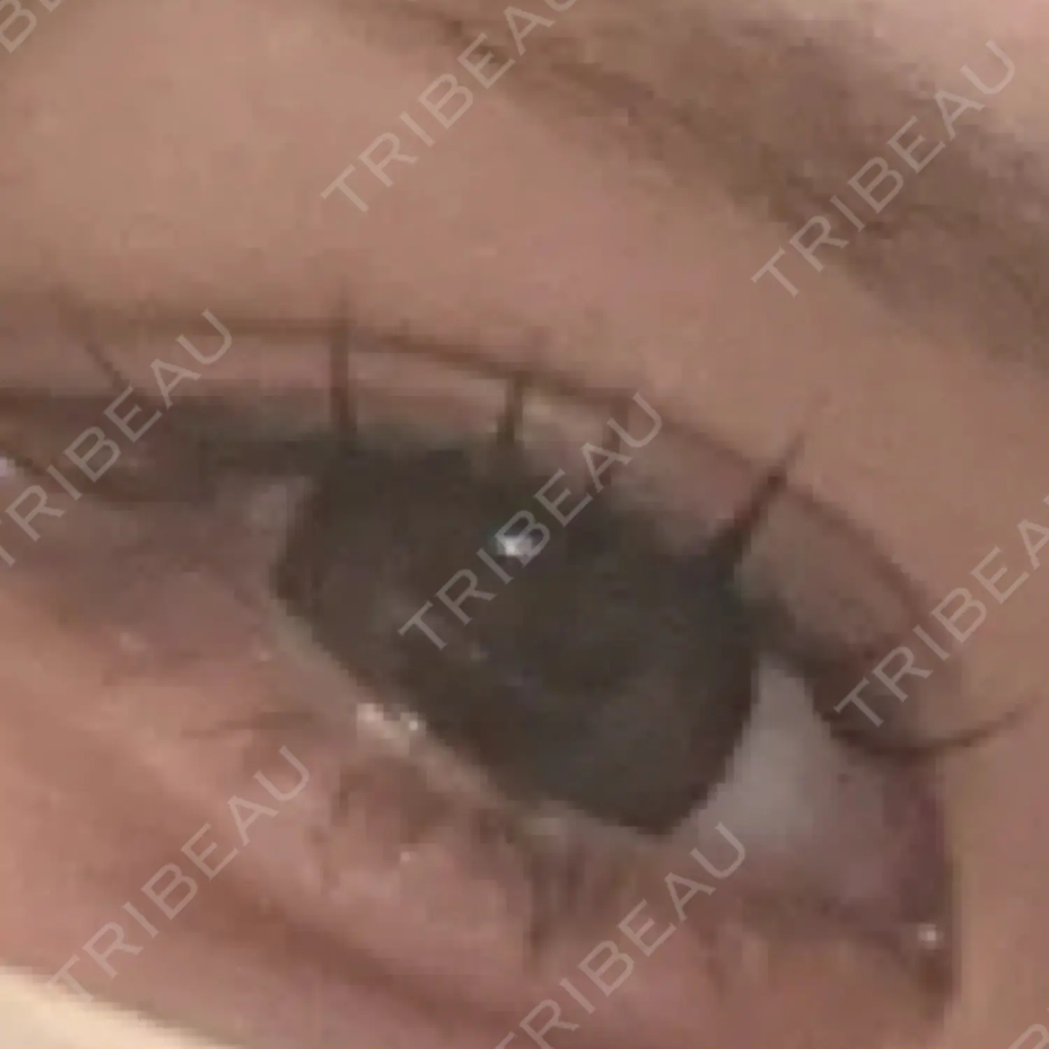 施術後の写真