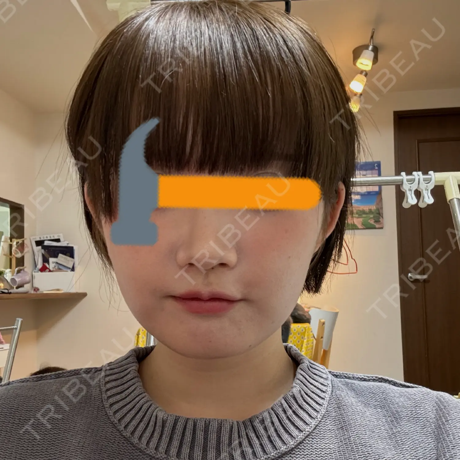 施術後の写真