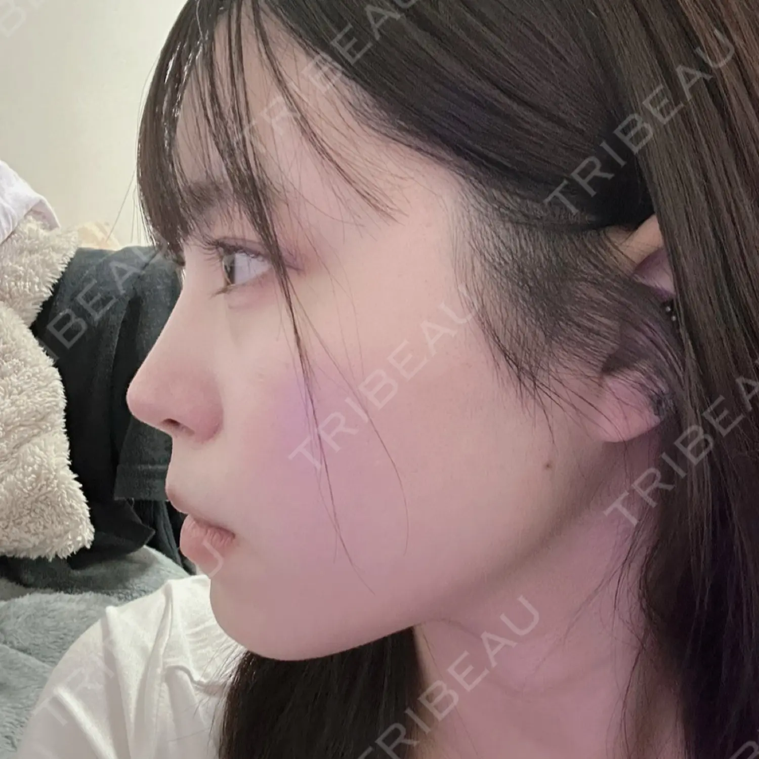 施術後の写真