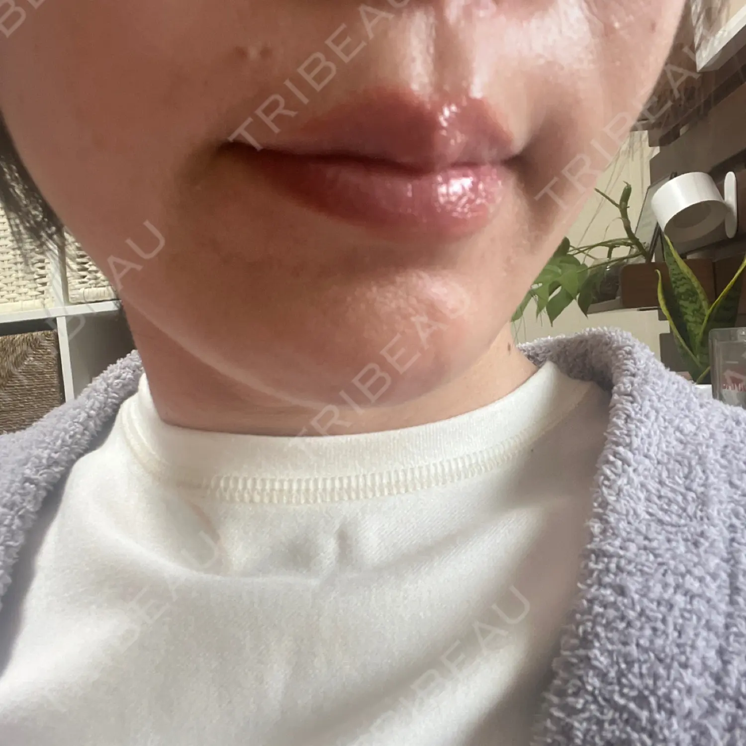 施術後の写真