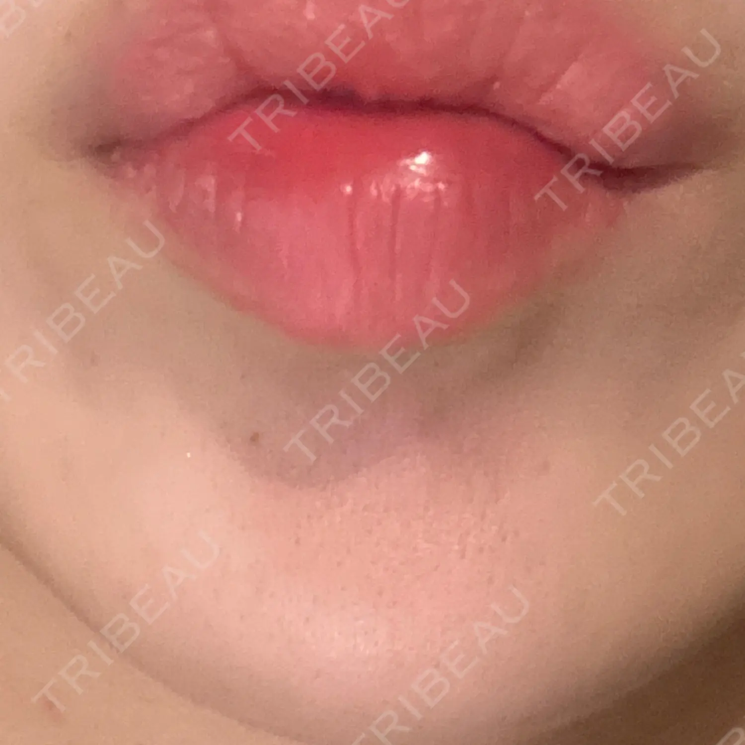施術後の写真