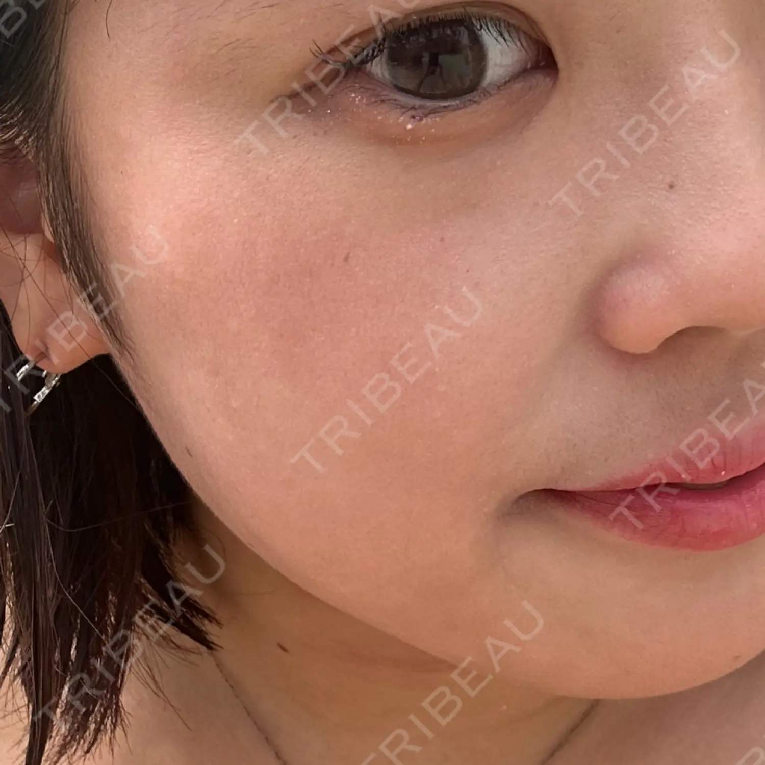 施術後の写真