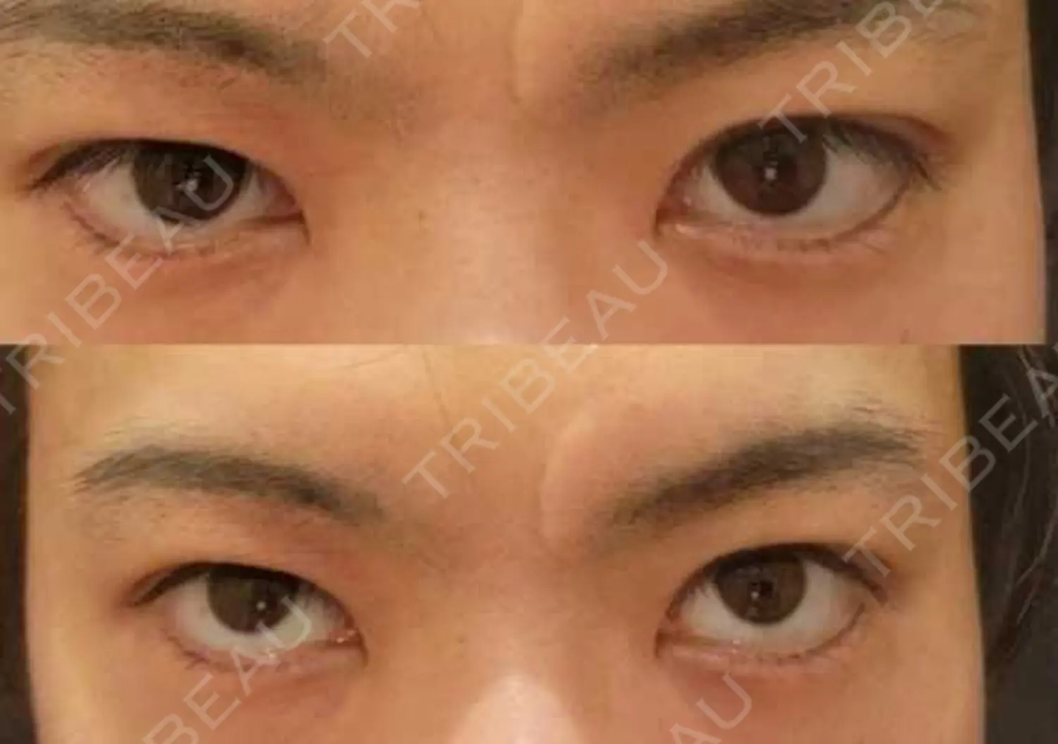 施術後の写真