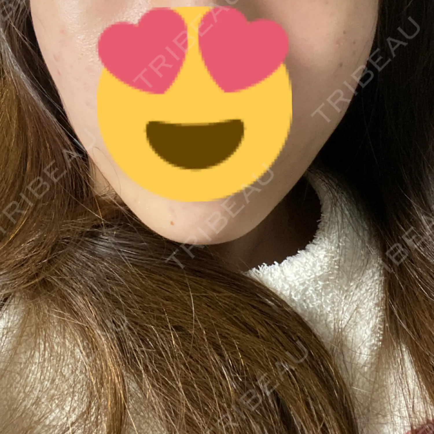 施術後の写真