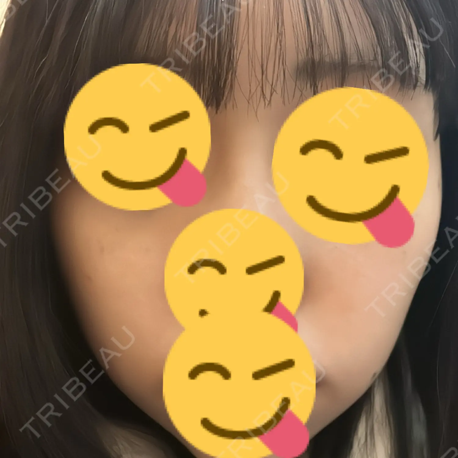 施術後の写真