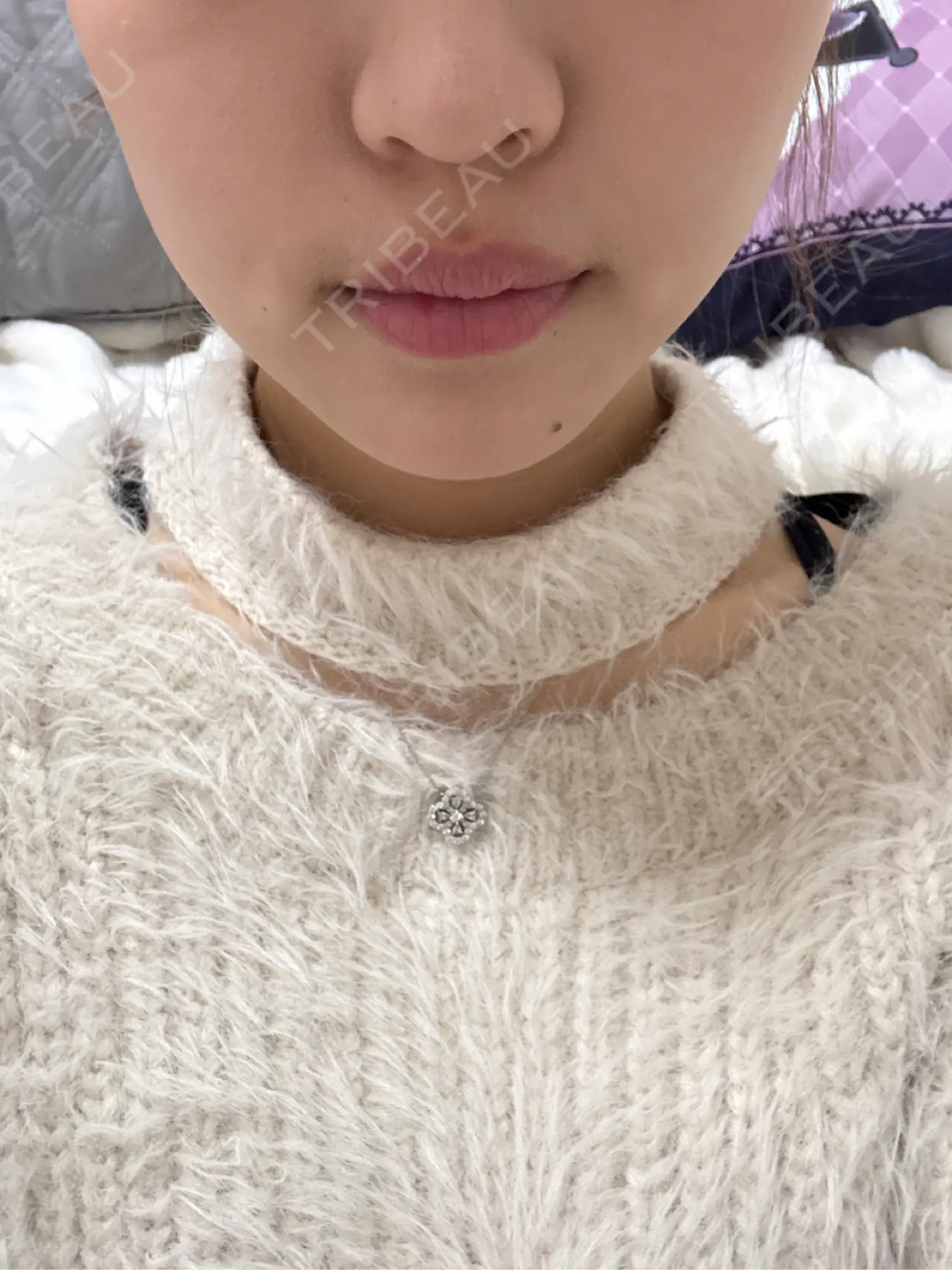 施術後の写真