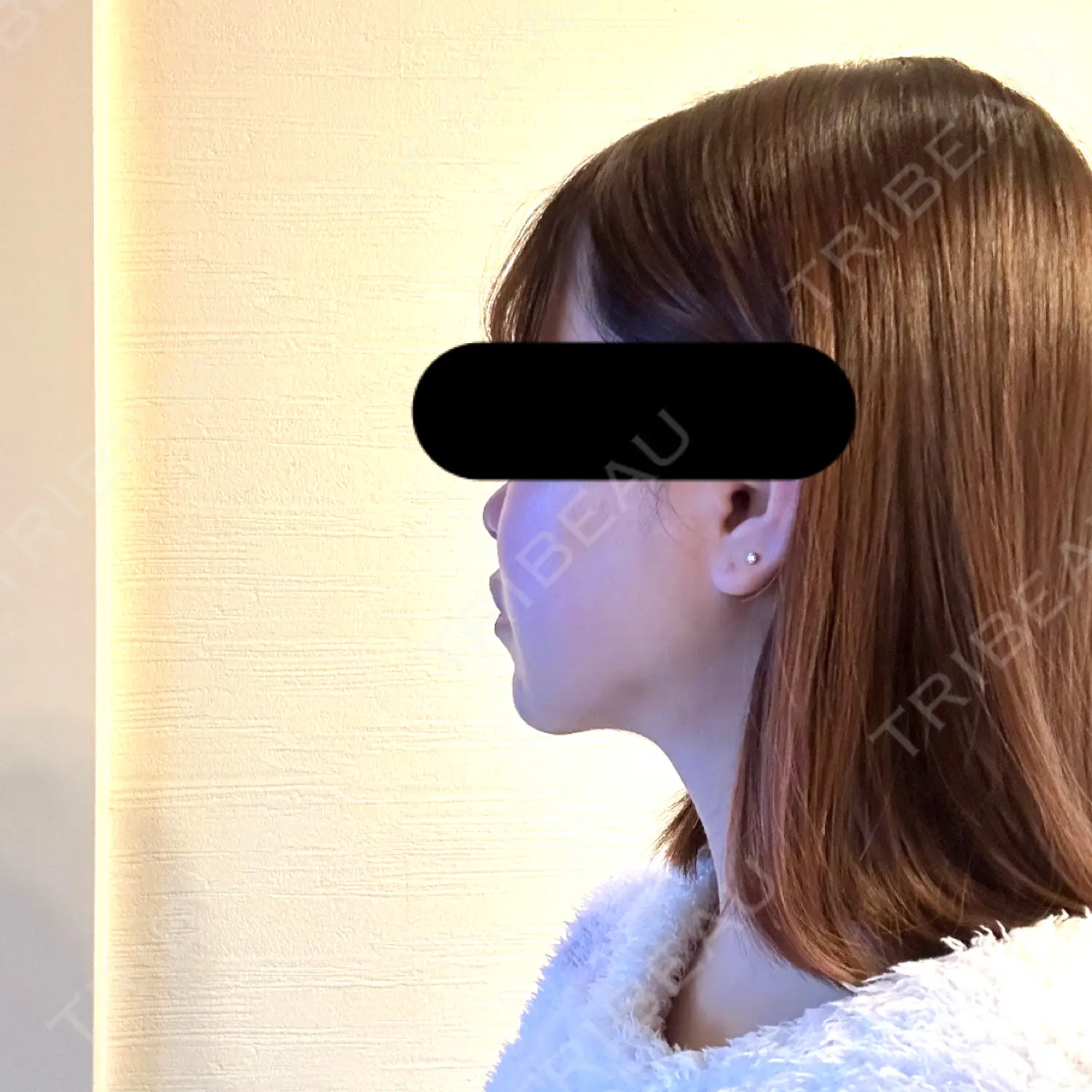 施術後の写真