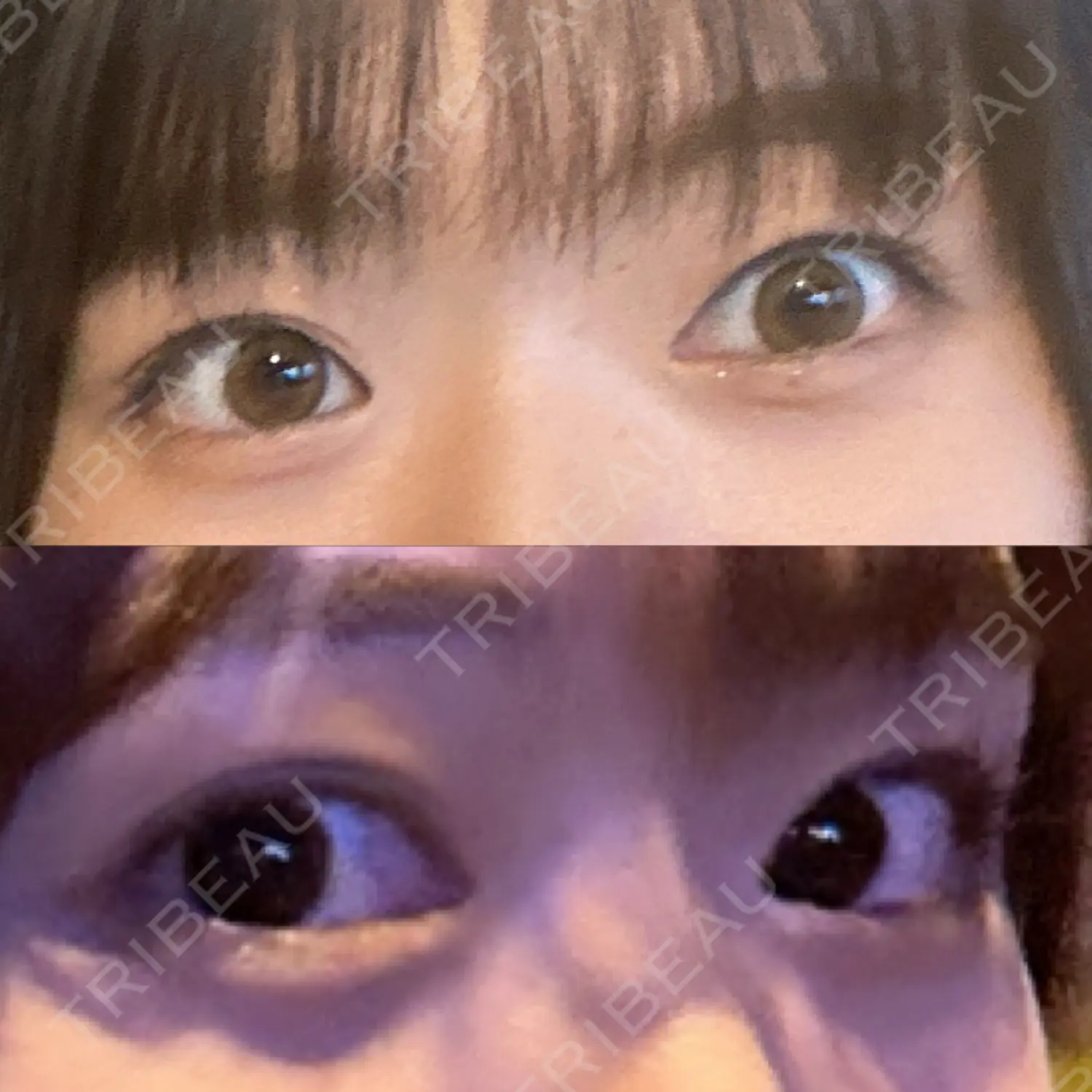 施術後の写真