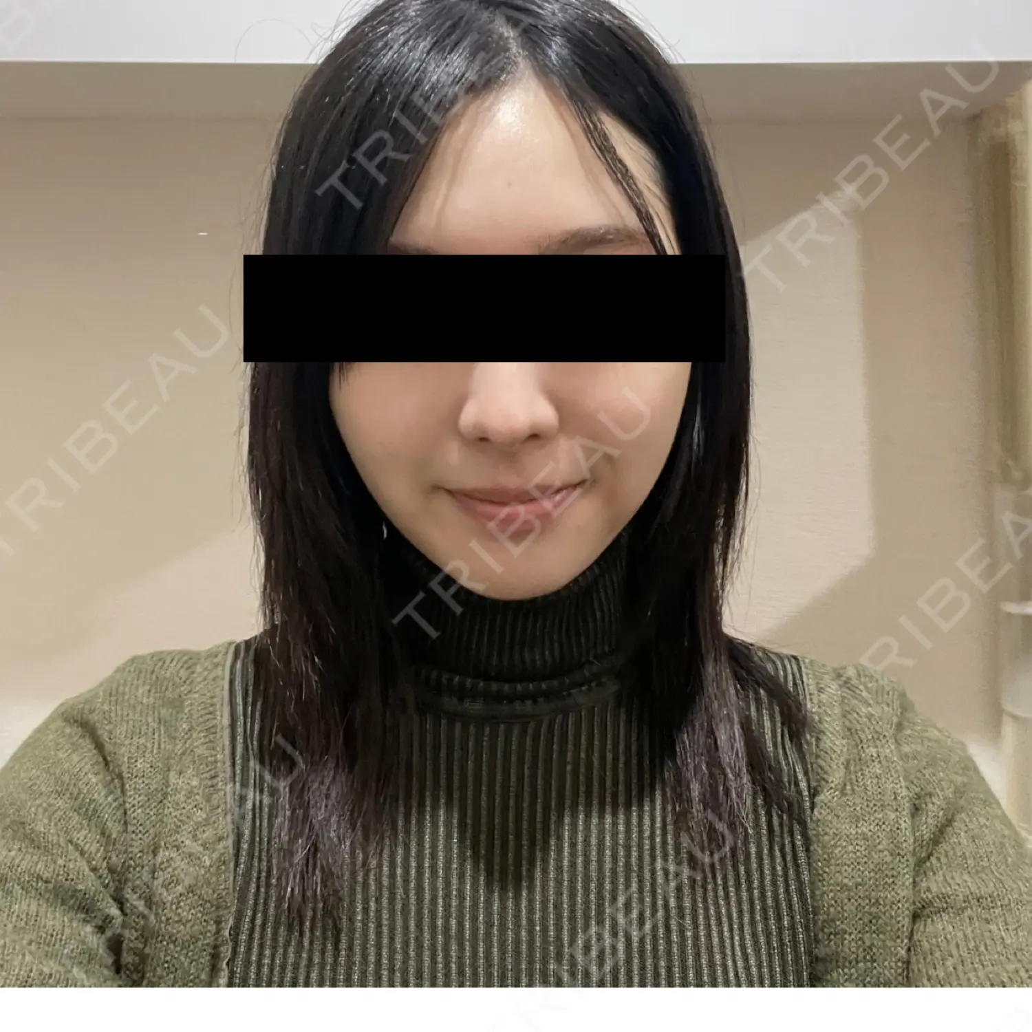 施術後の写真