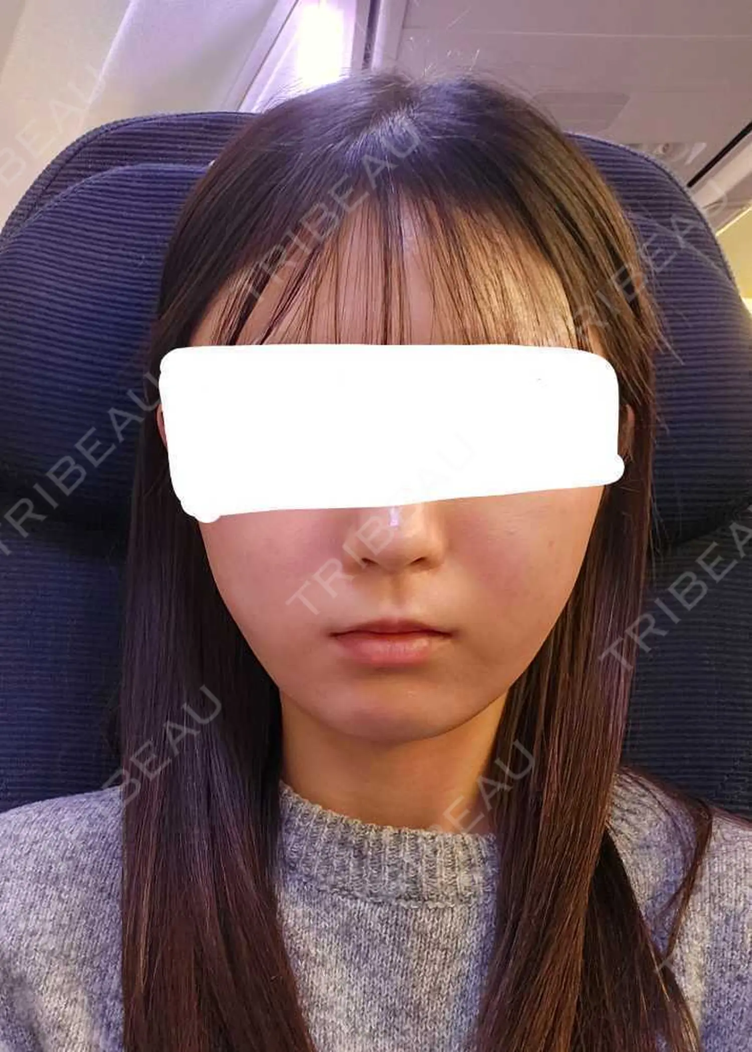 施術後の写真