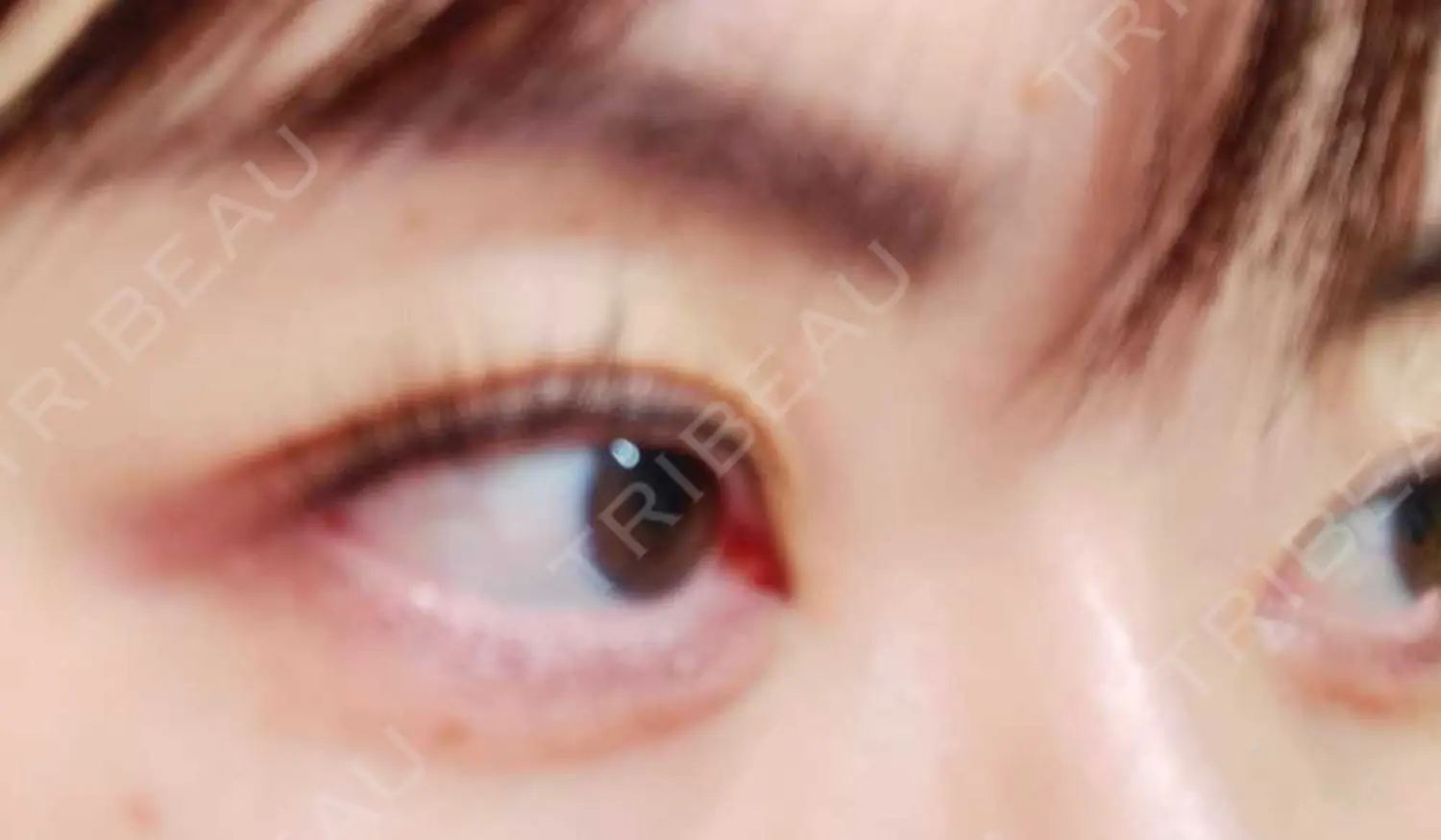 施術後の写真