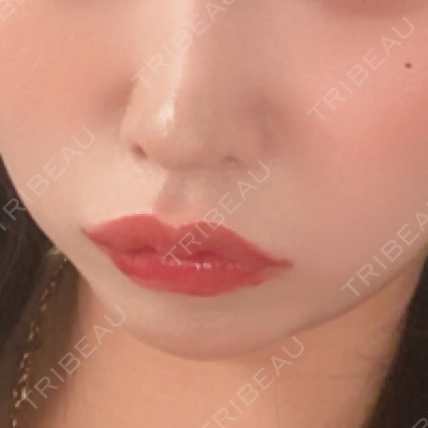 施術後の写真