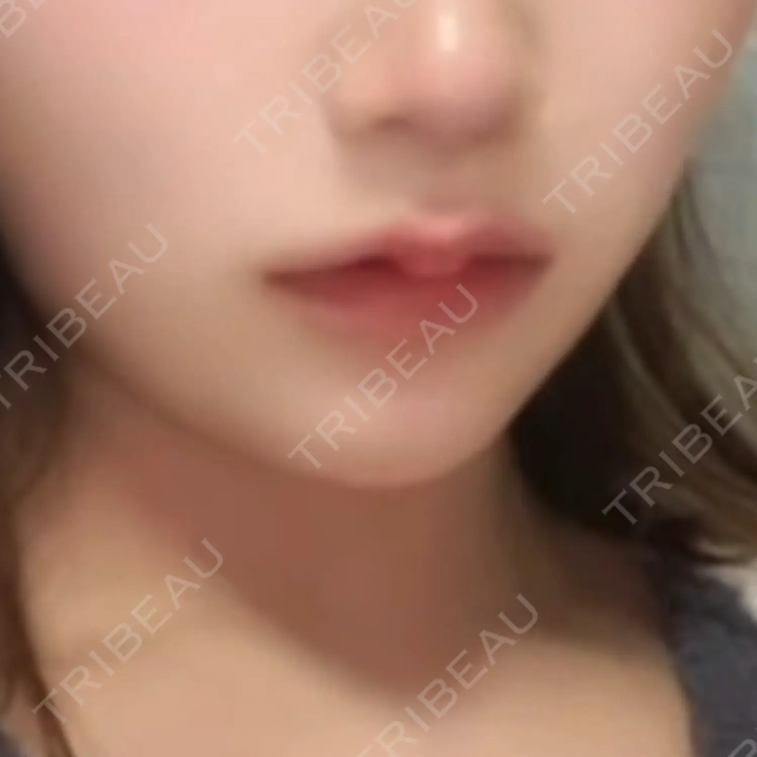 施術後の写真