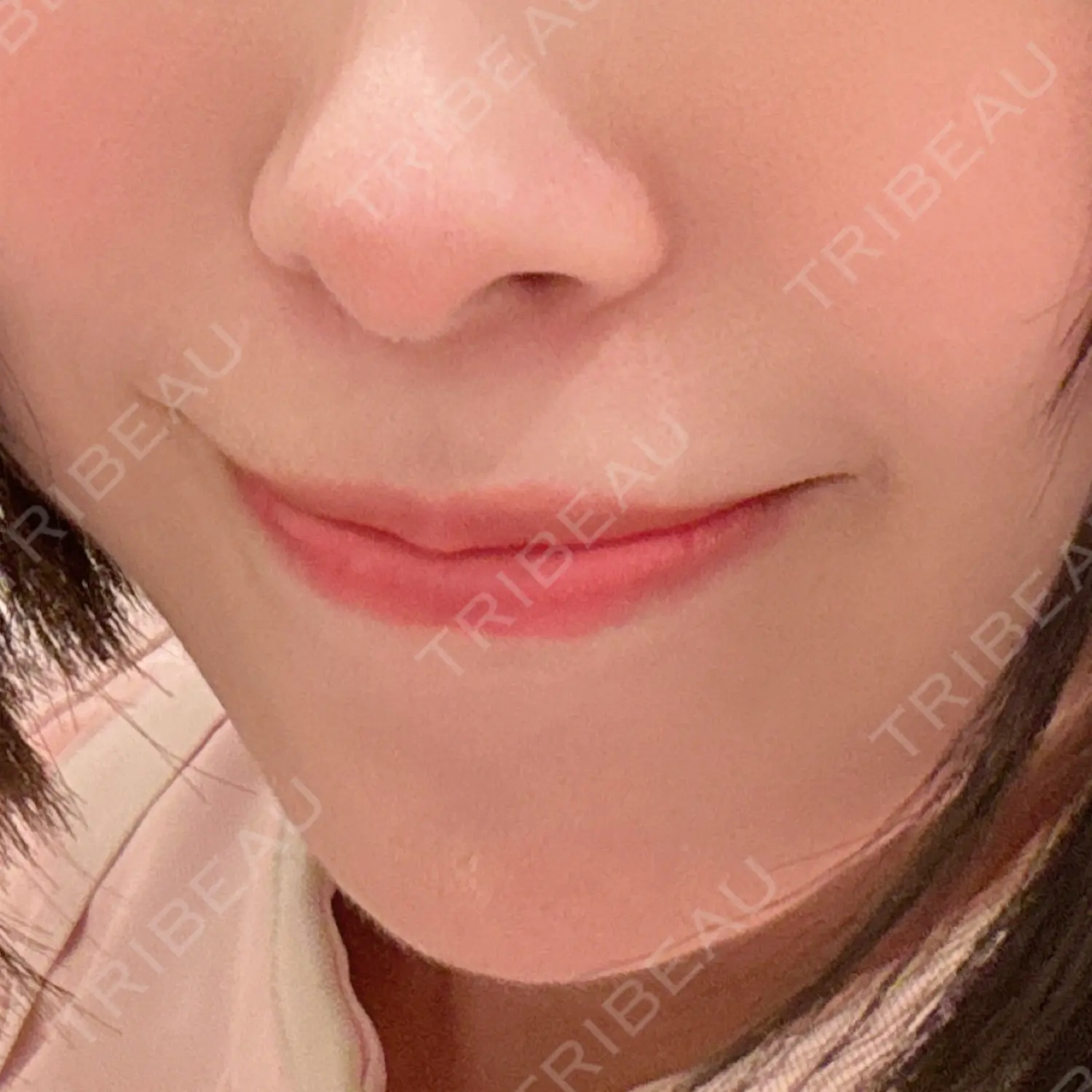施術後の写真
