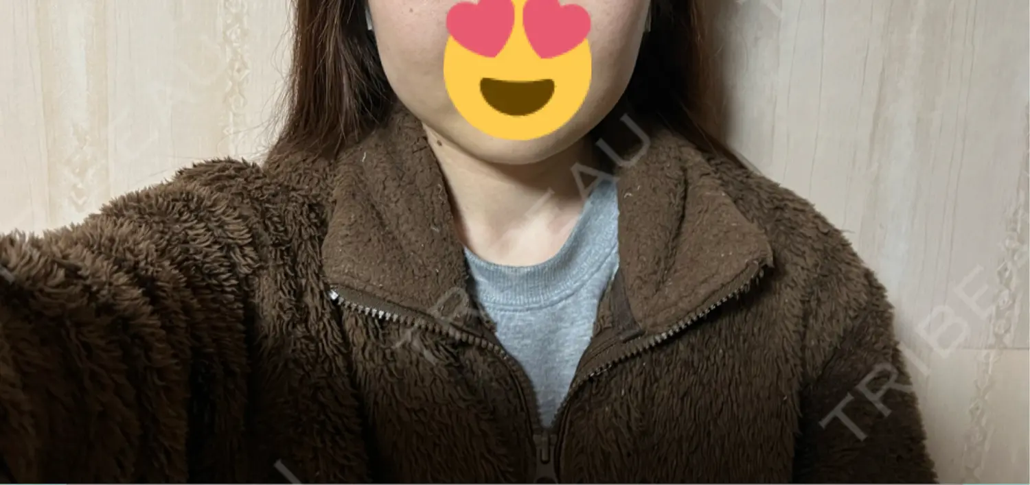 施術後の写真