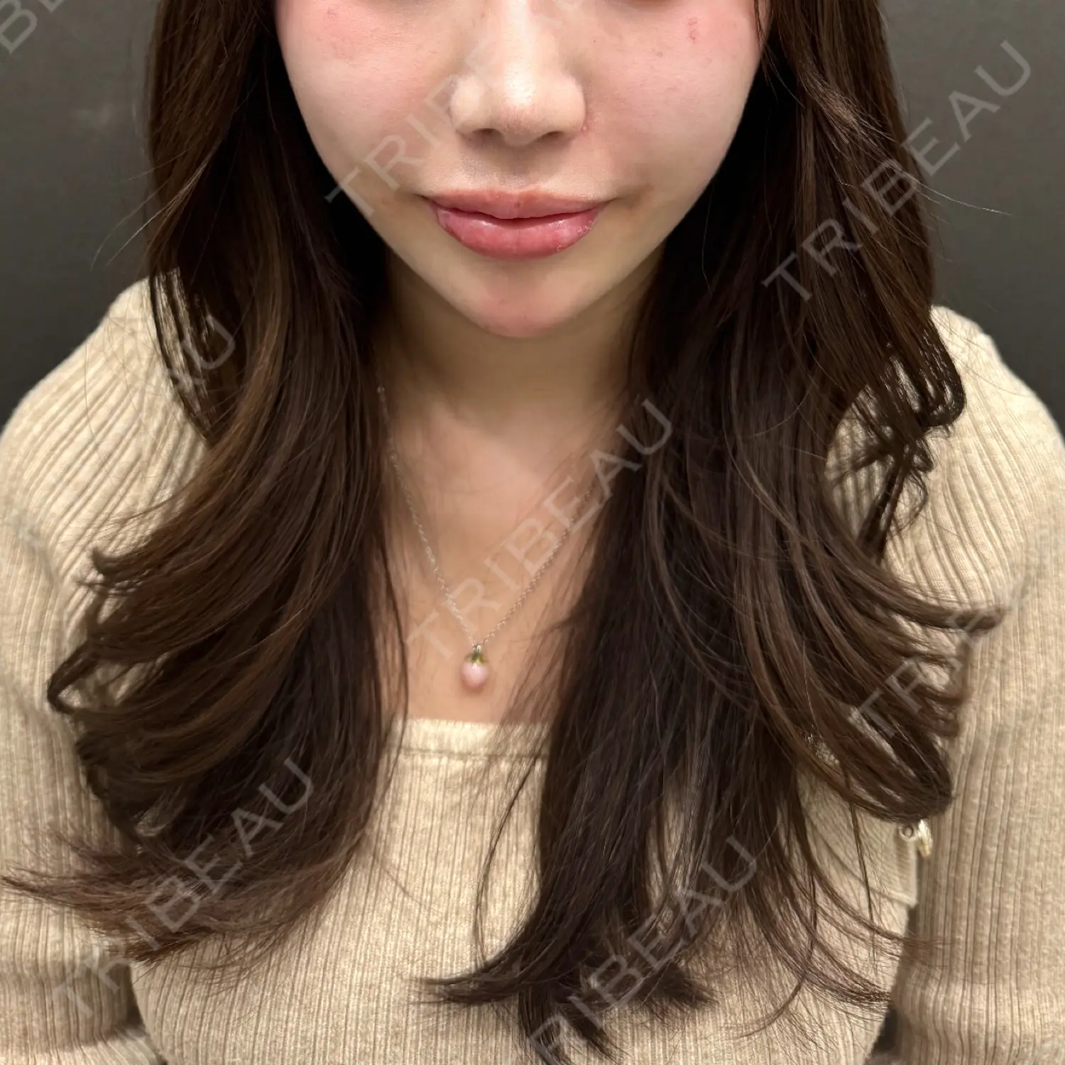 施術後の写真