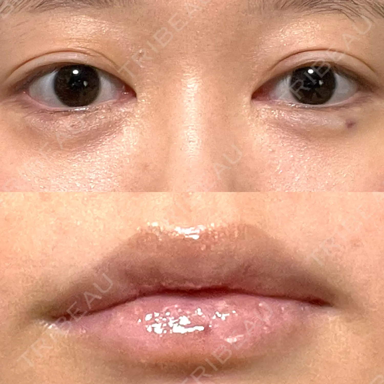 施術後の写真