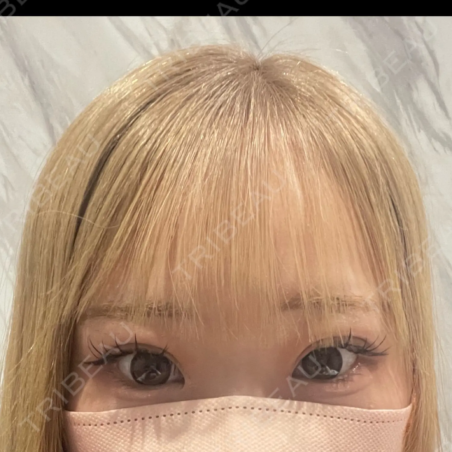 施術後の写真