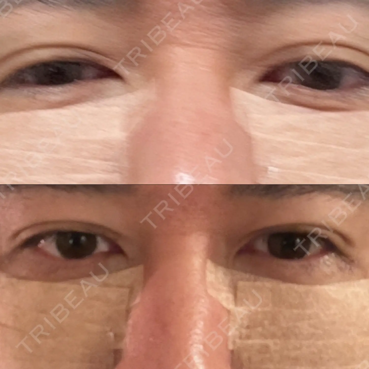 施術後の写真
