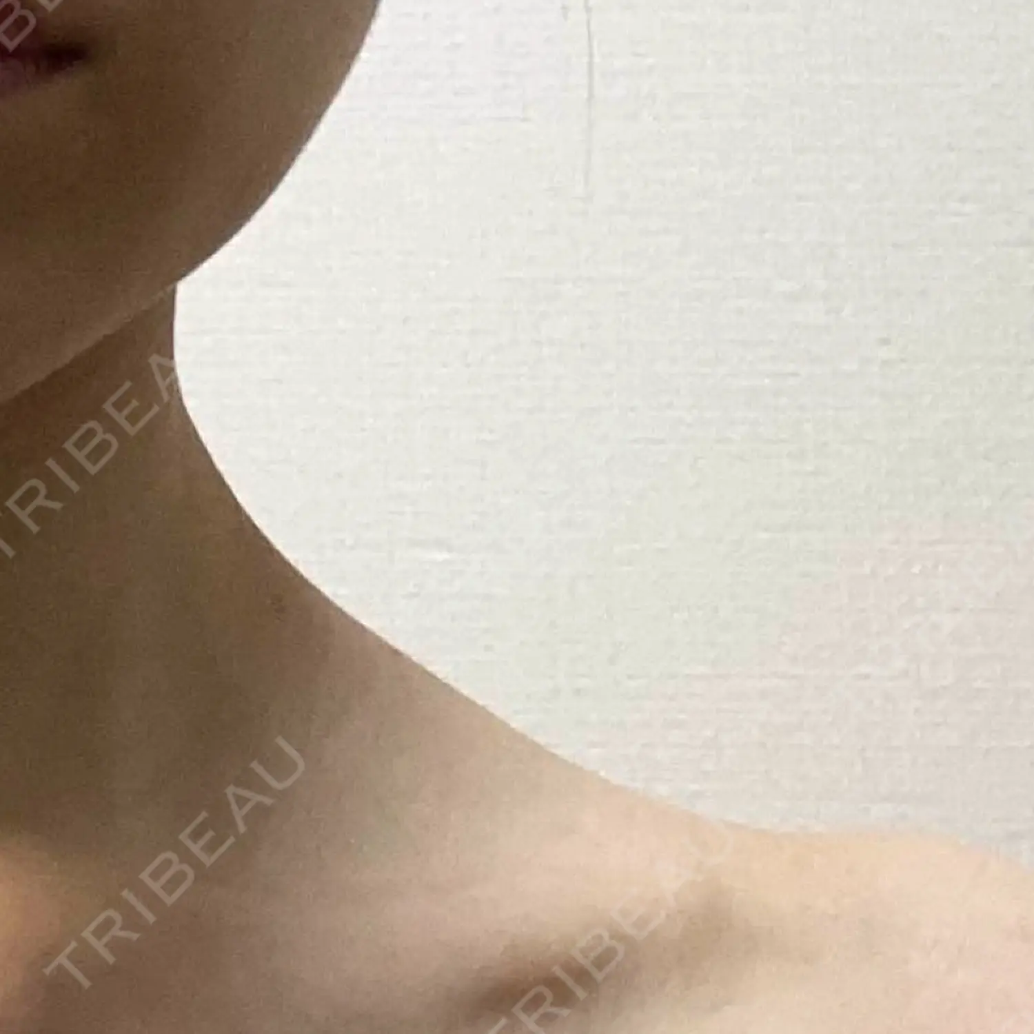 施術後の写真