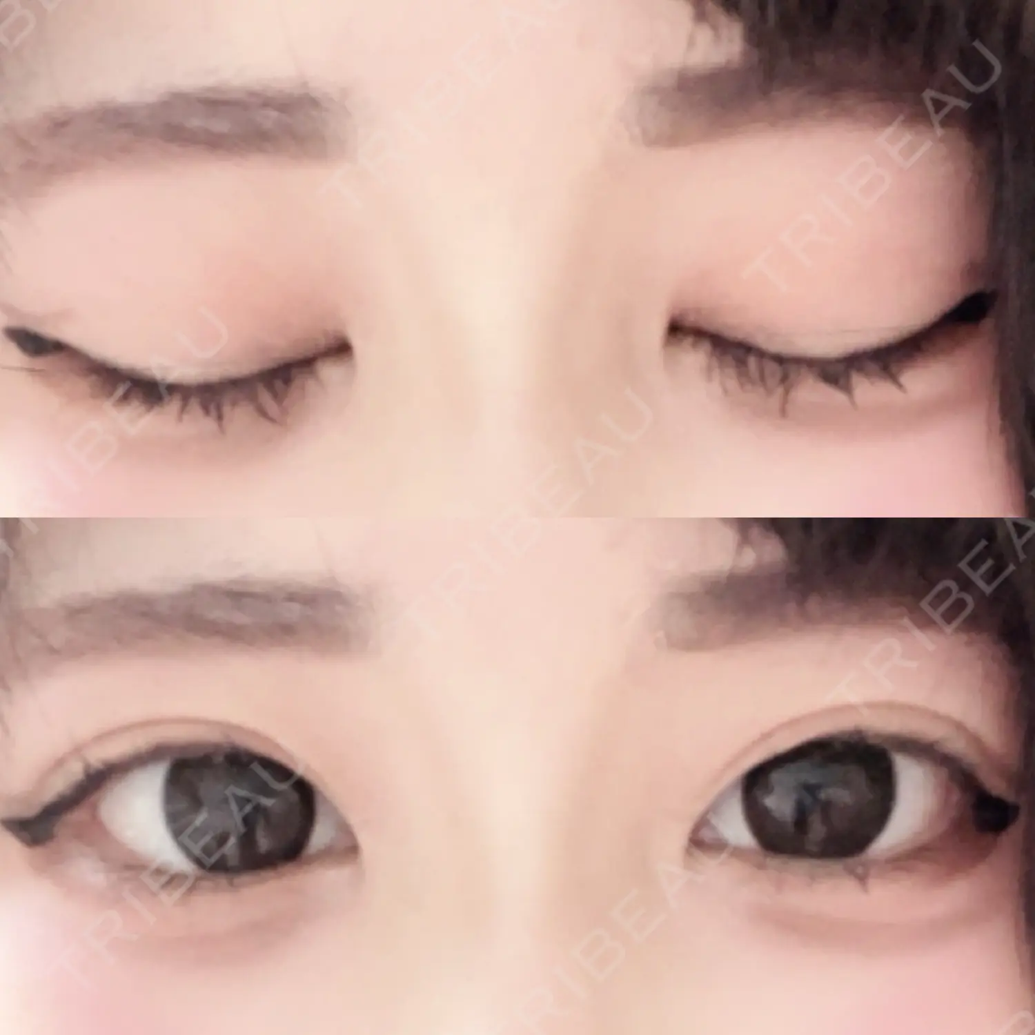 施術後の写真
