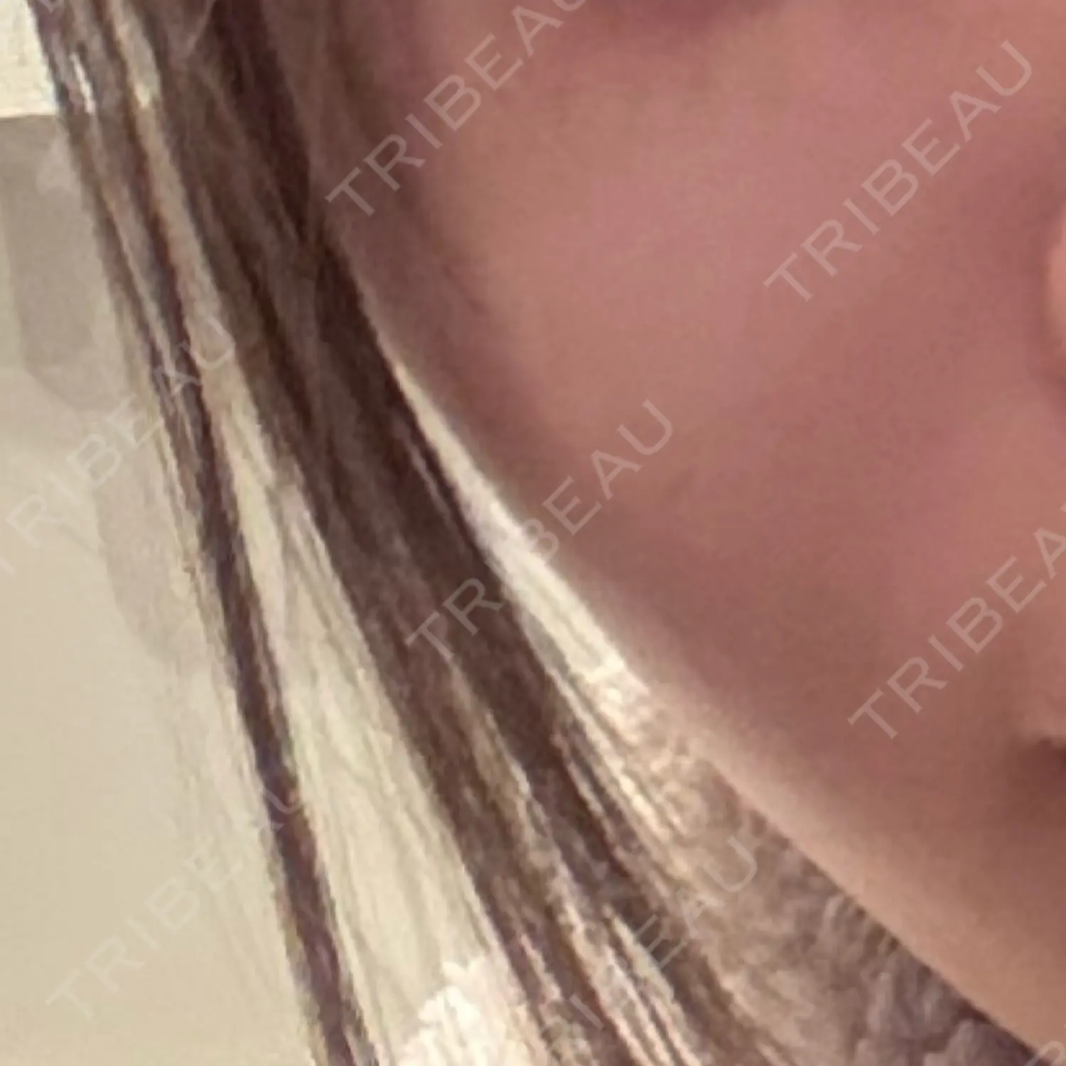施術後の写真