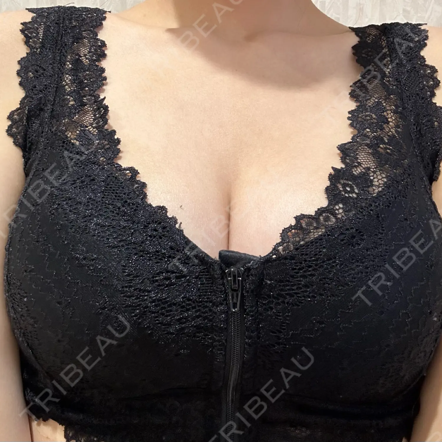施術後の写真