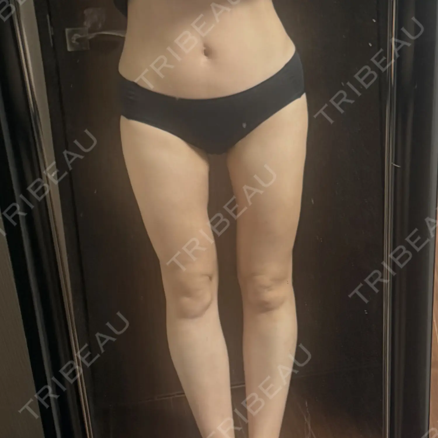 施術後の写真