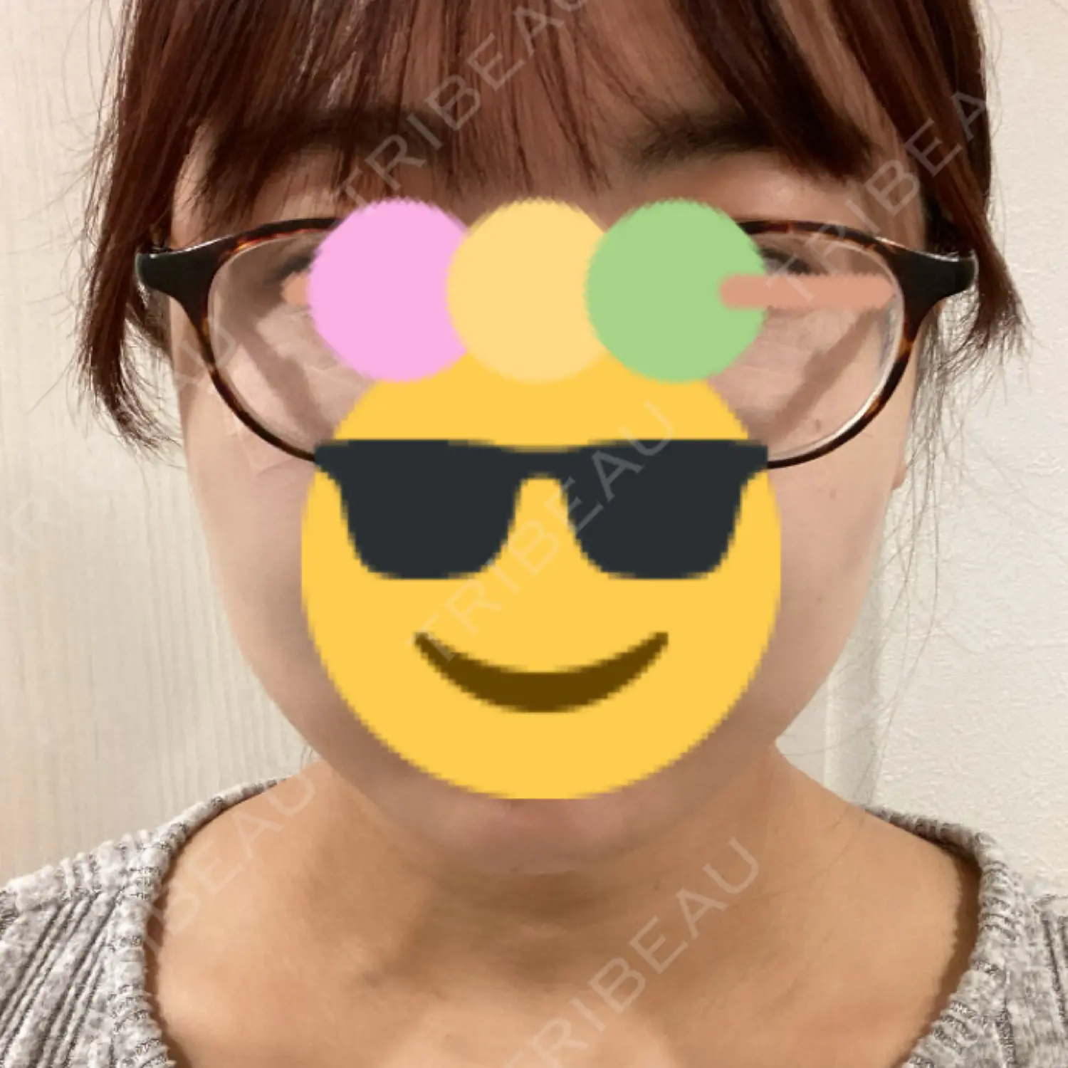 施術後の写真