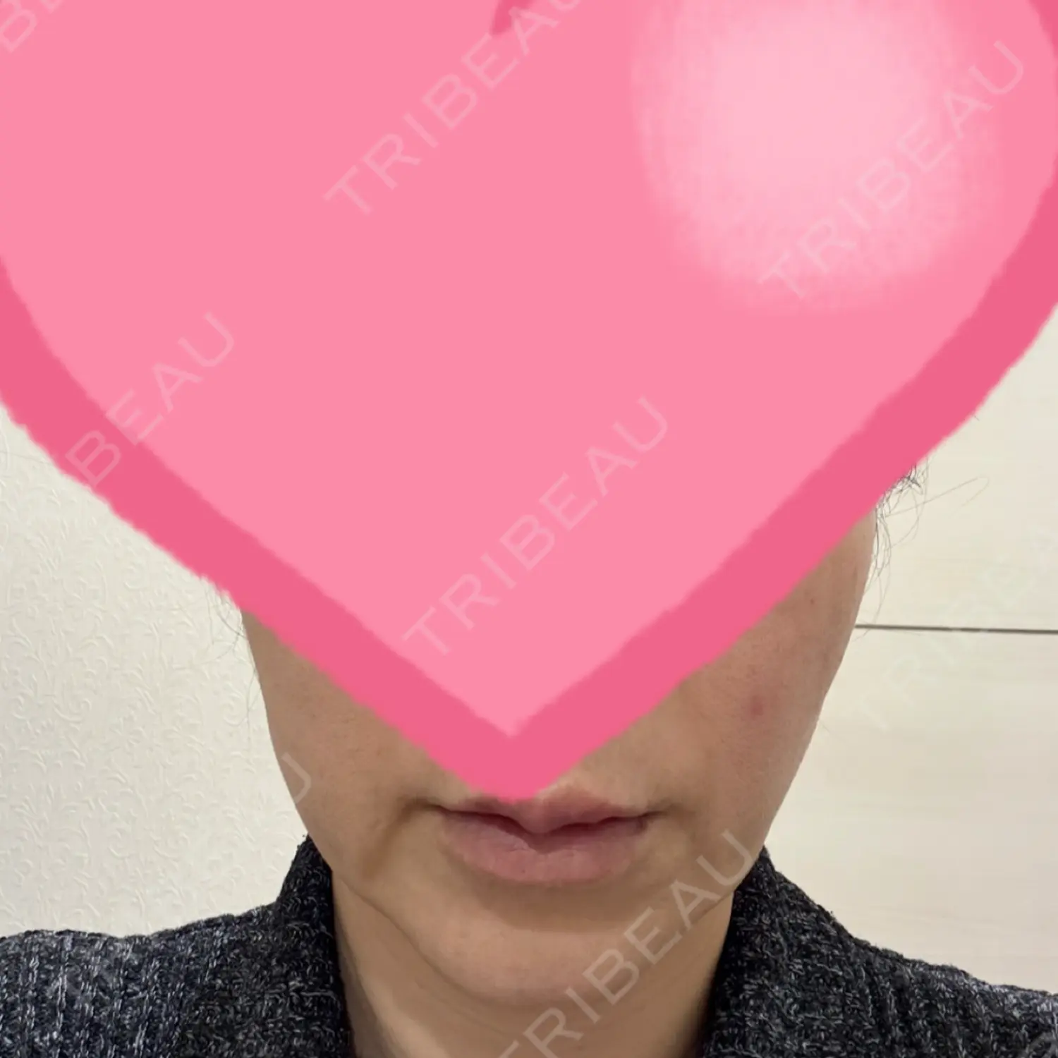 施術後の写真