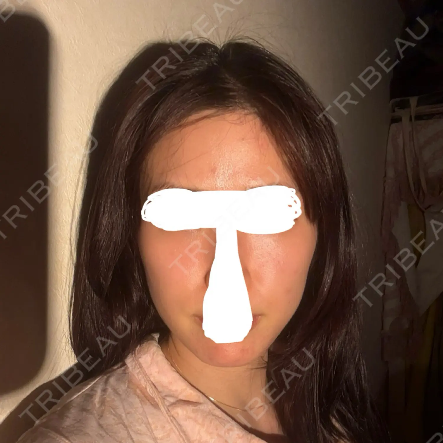 施術後の写真