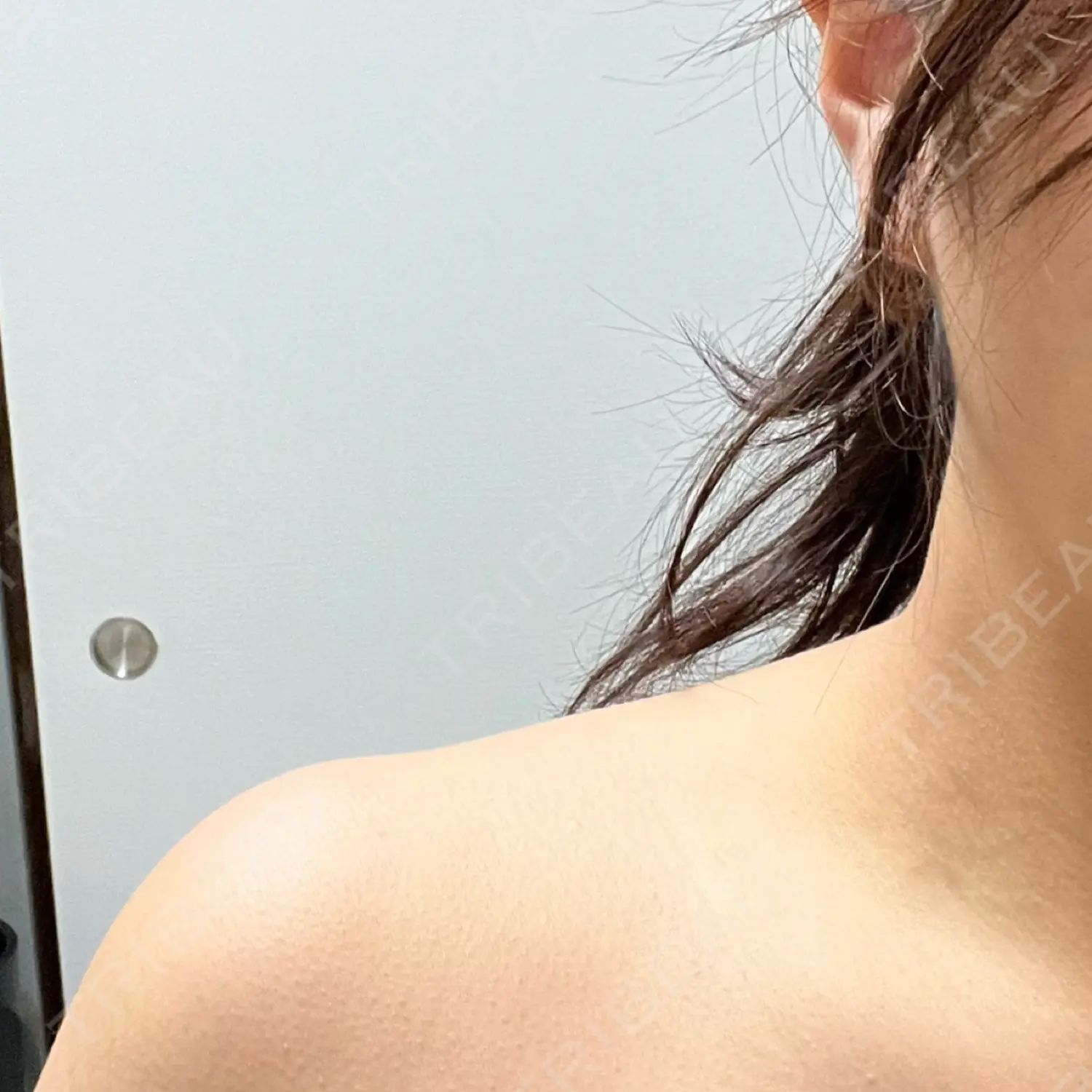 施術後の写真