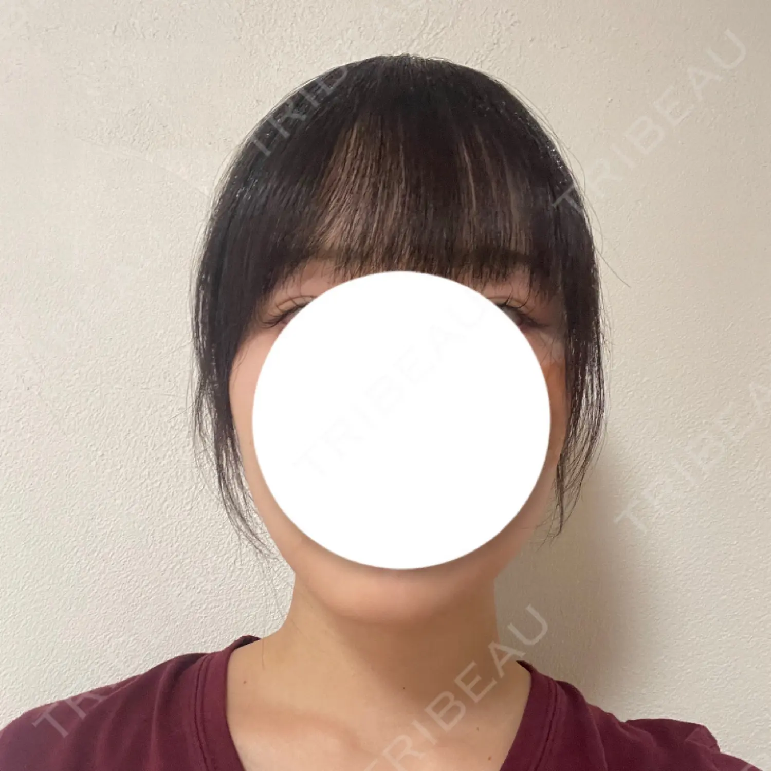 施術後の写真