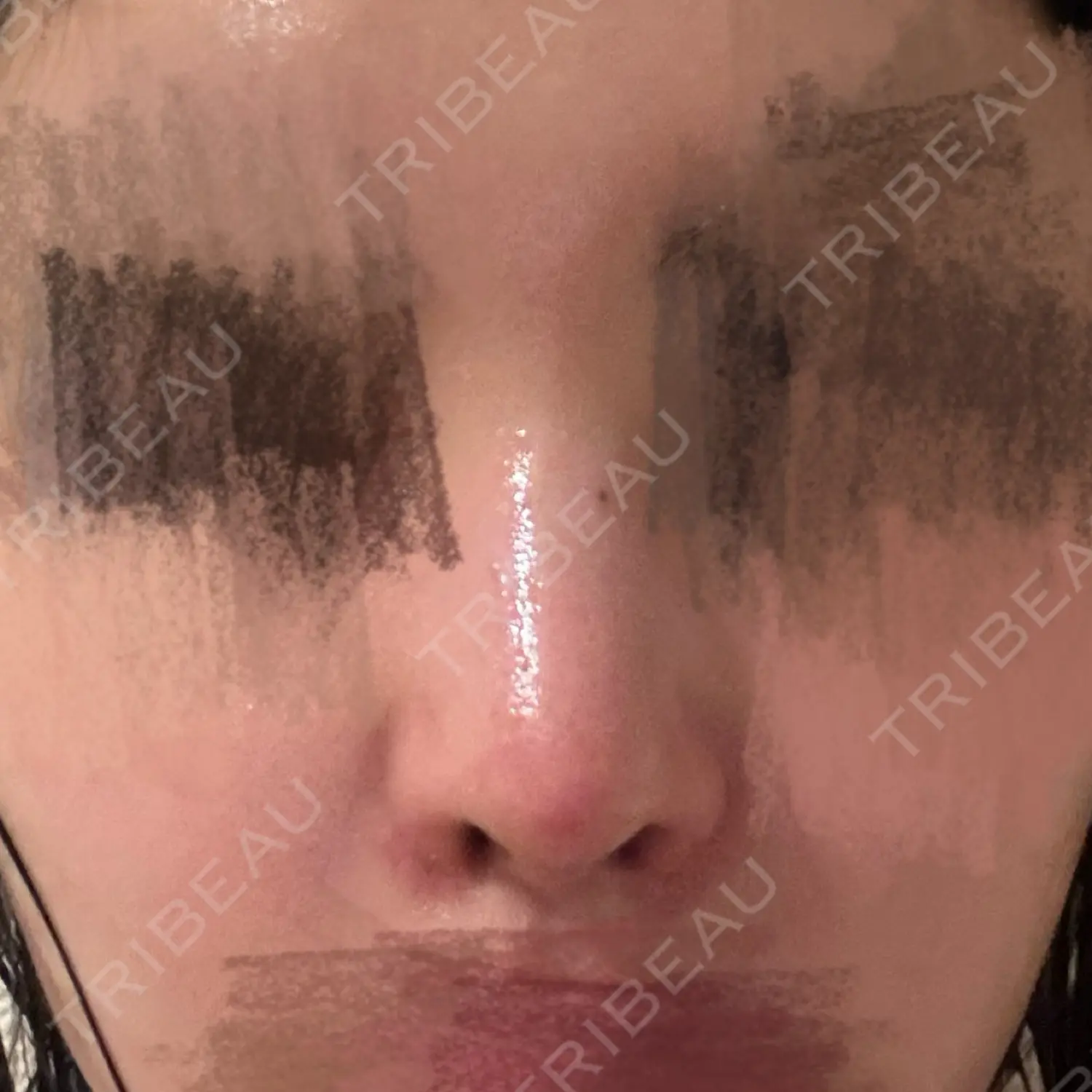 施術後の写真