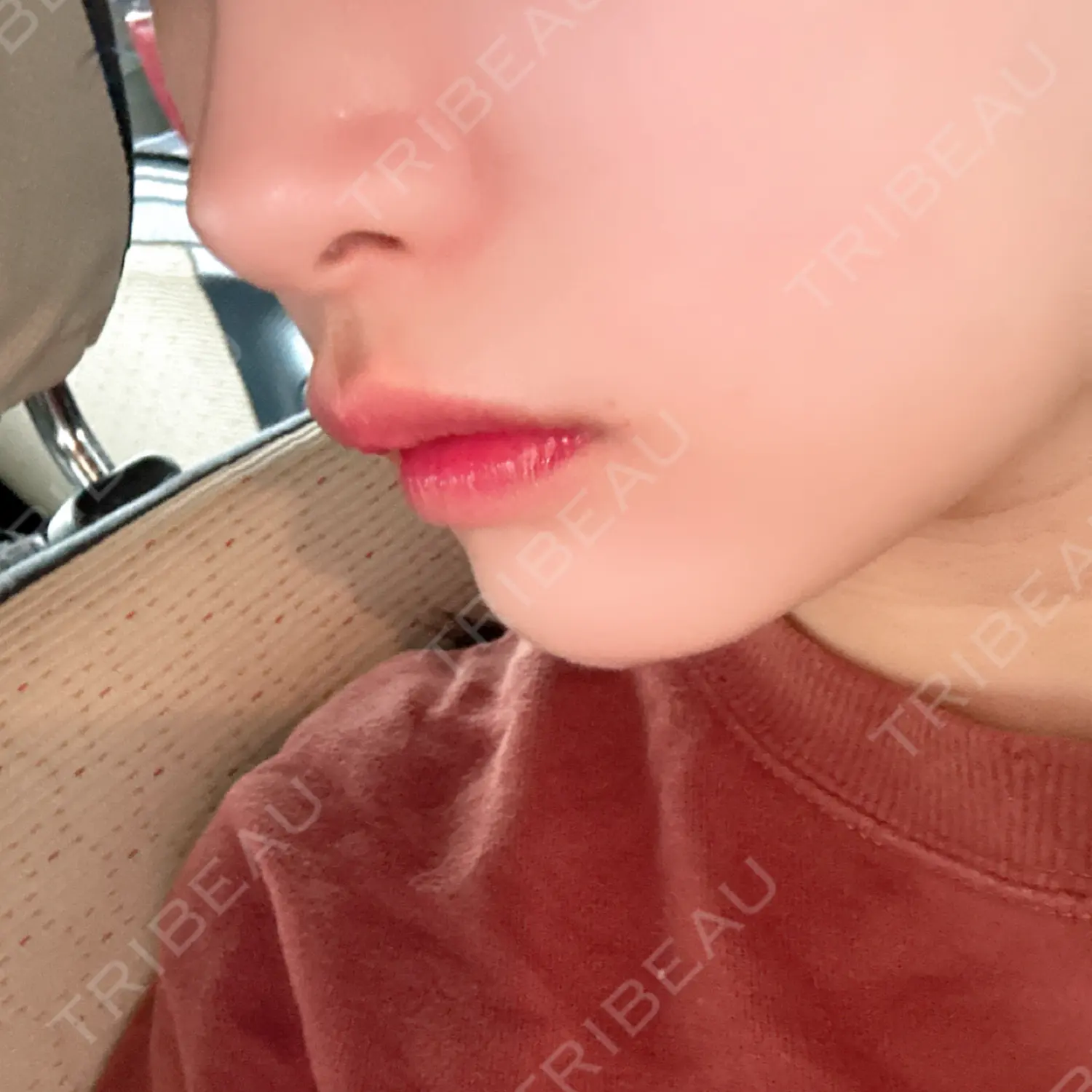 施術後の写真