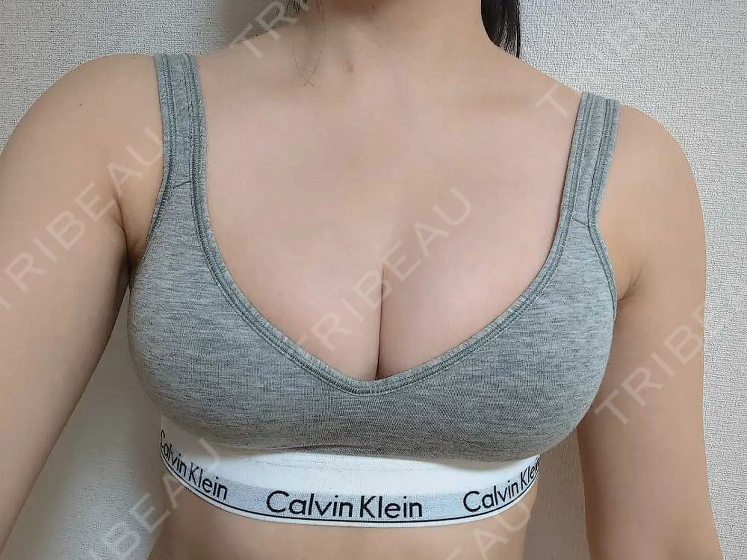 施術後の写真