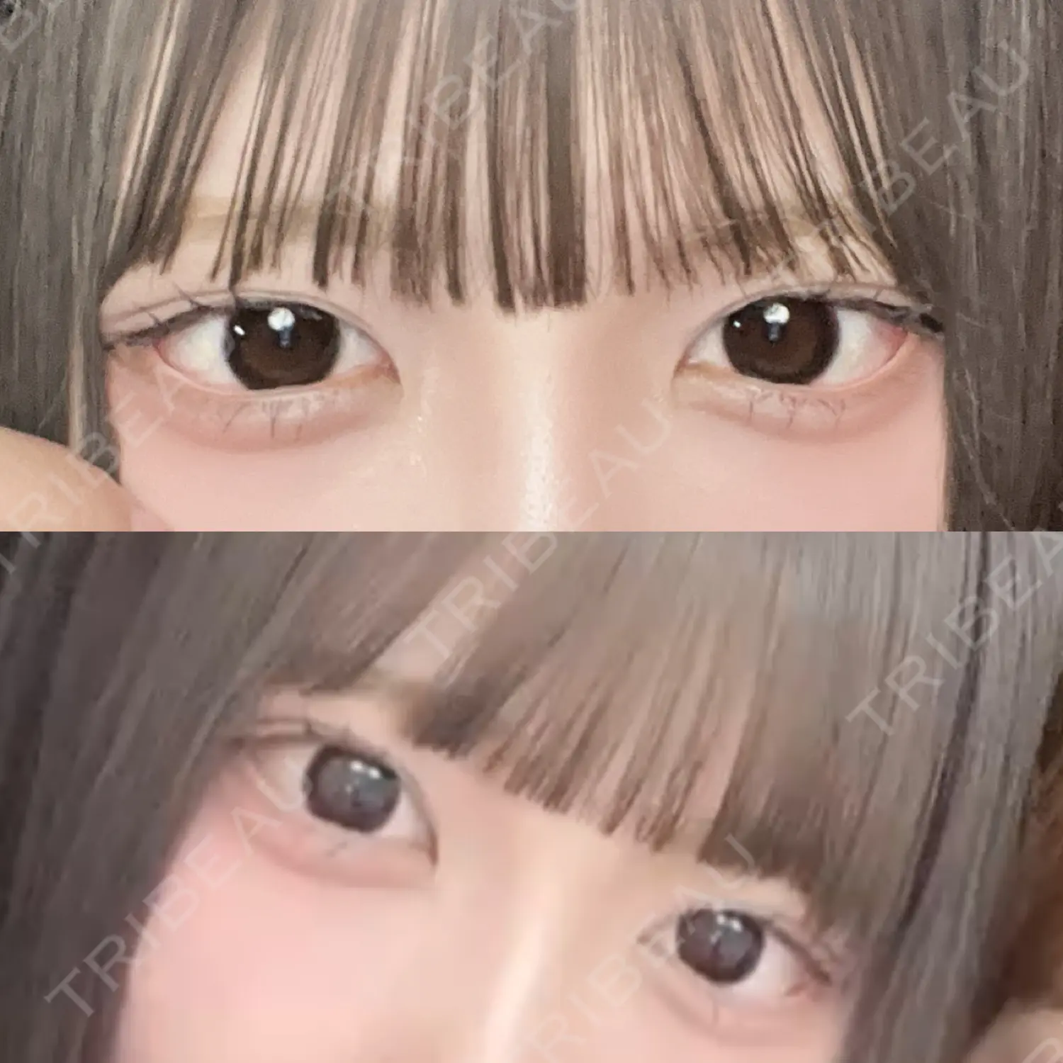 施術後の写真