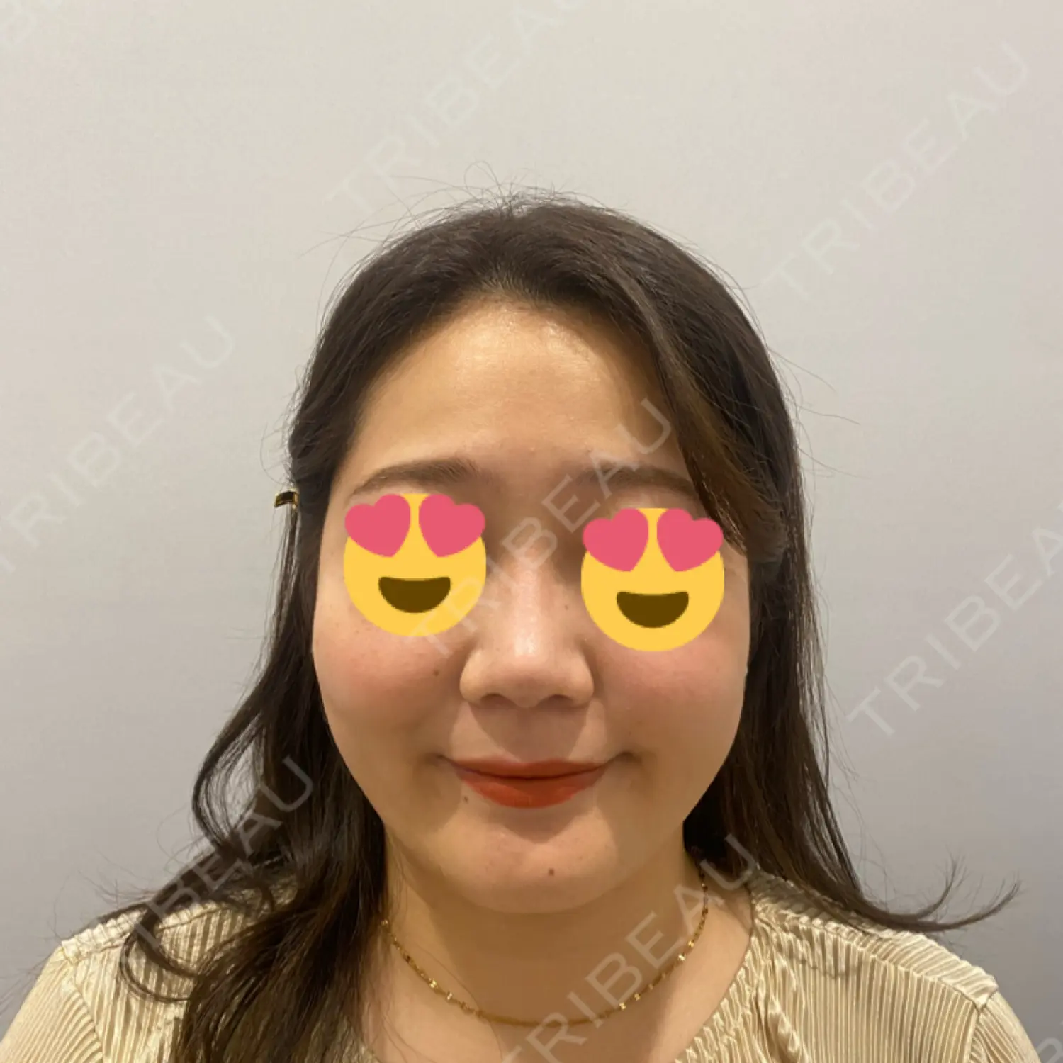 施術後の写真
