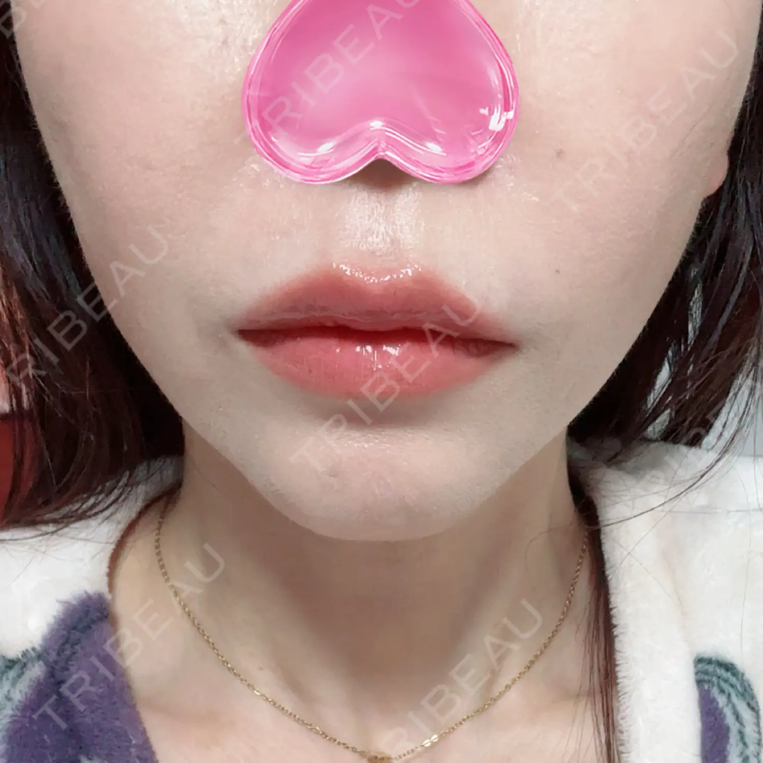 施術後の写真