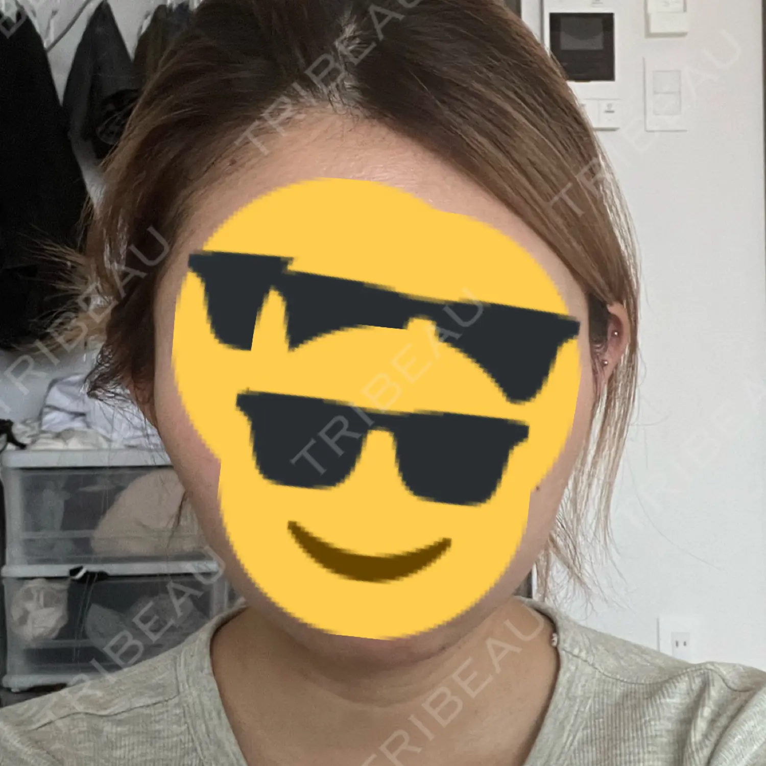 施術後の写真