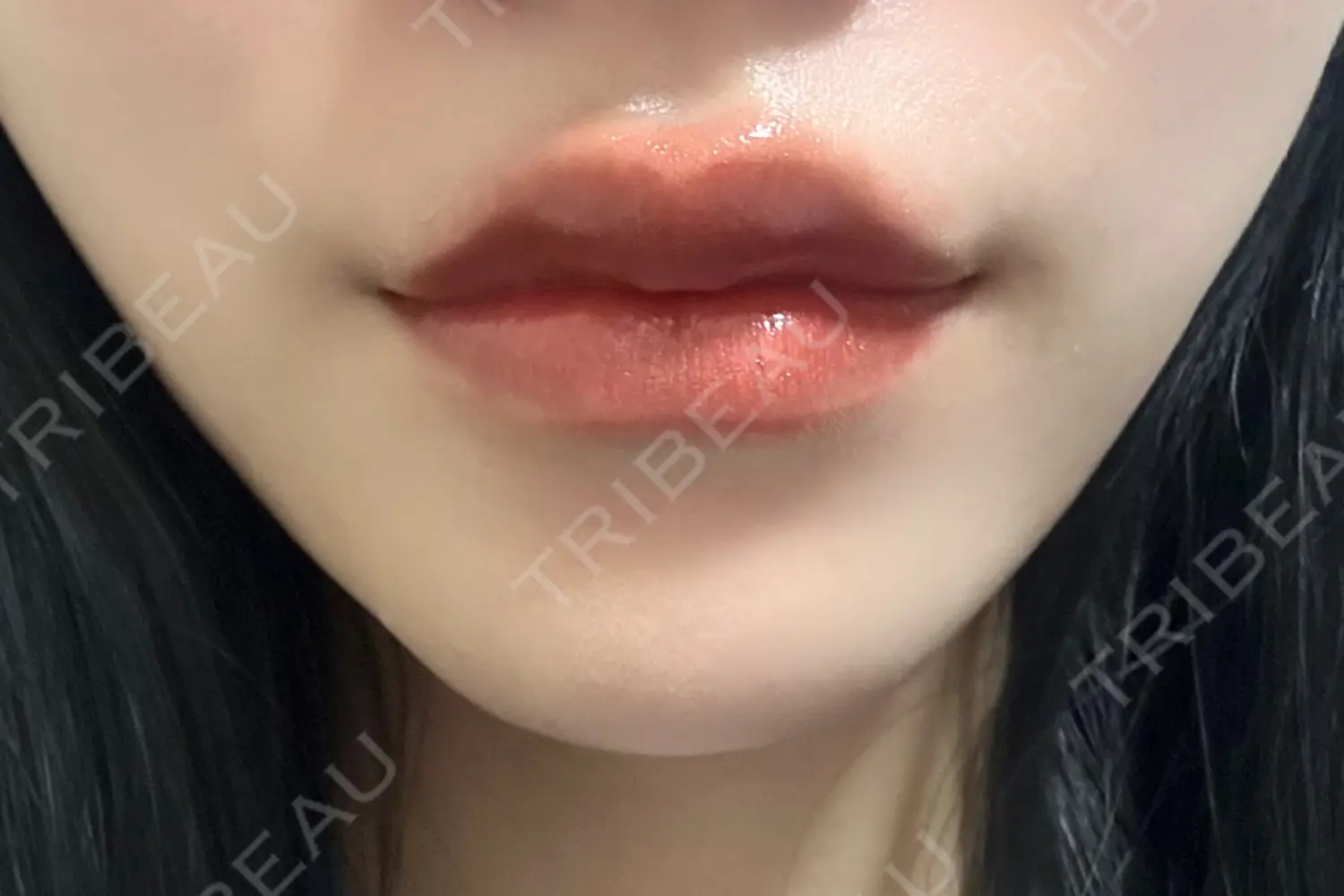 施術後の写真