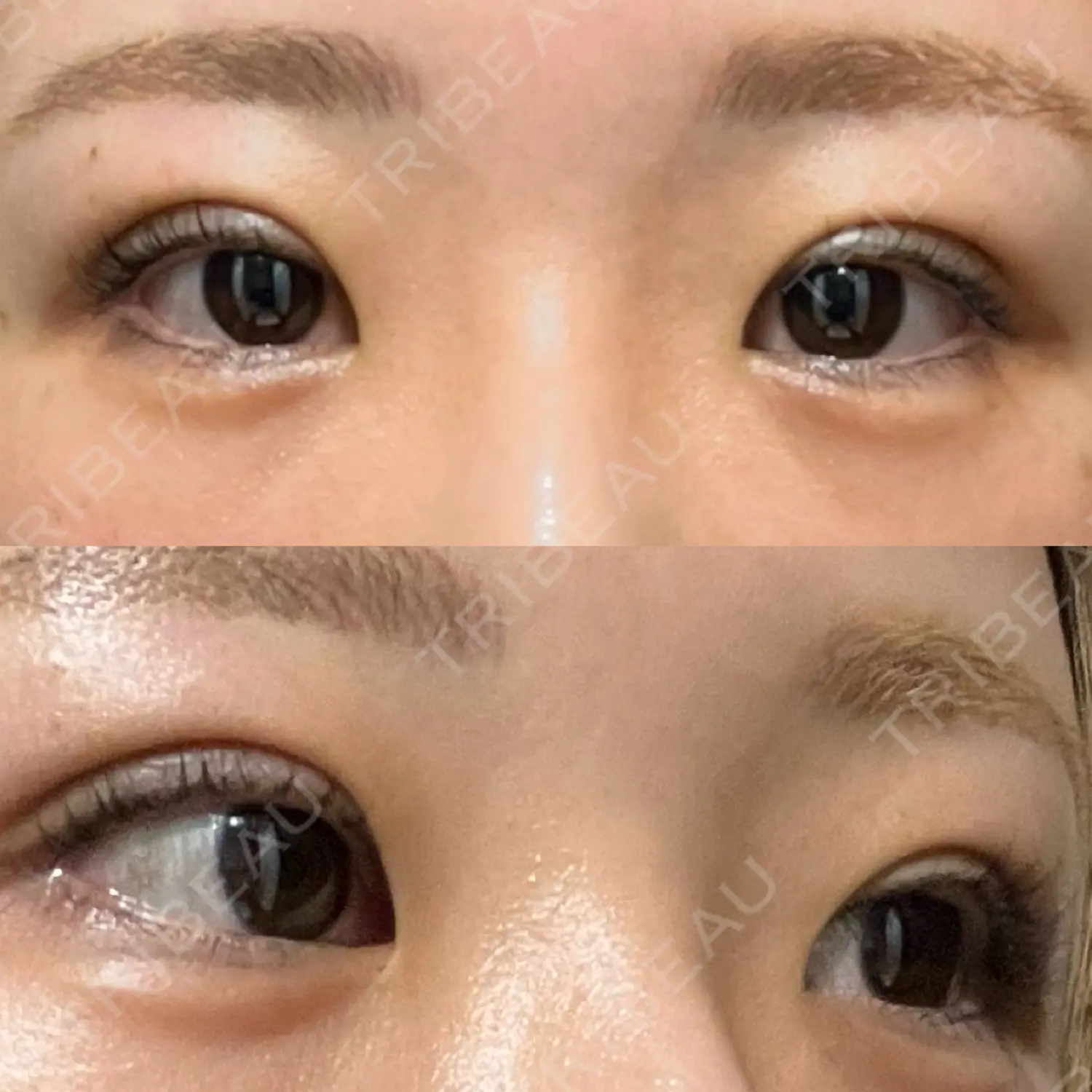 施術後の写真