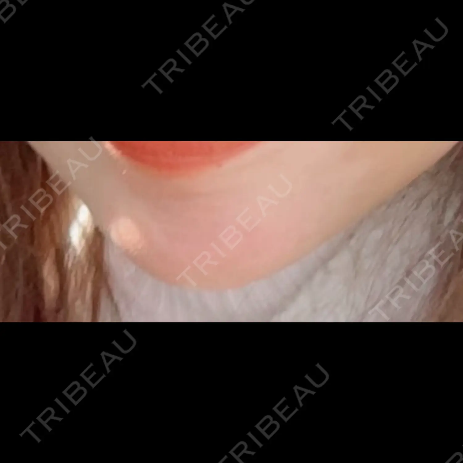 施術後の写真