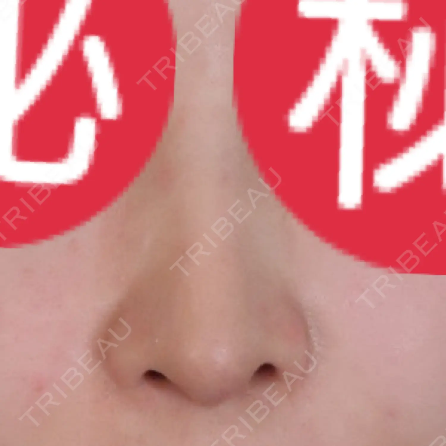 施術後の写真